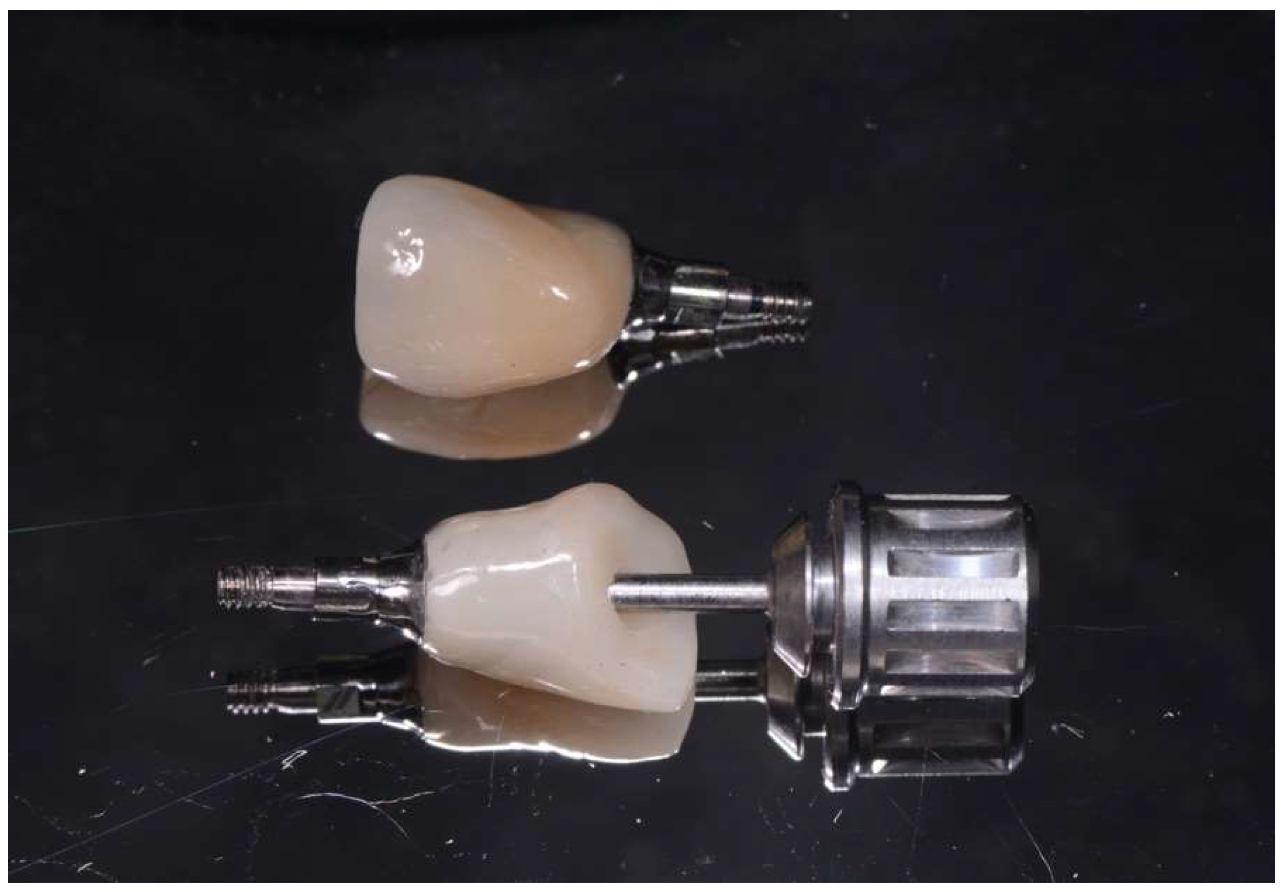 Prosthesis 06 00057 g007 Prosthesis 06 00057 g007