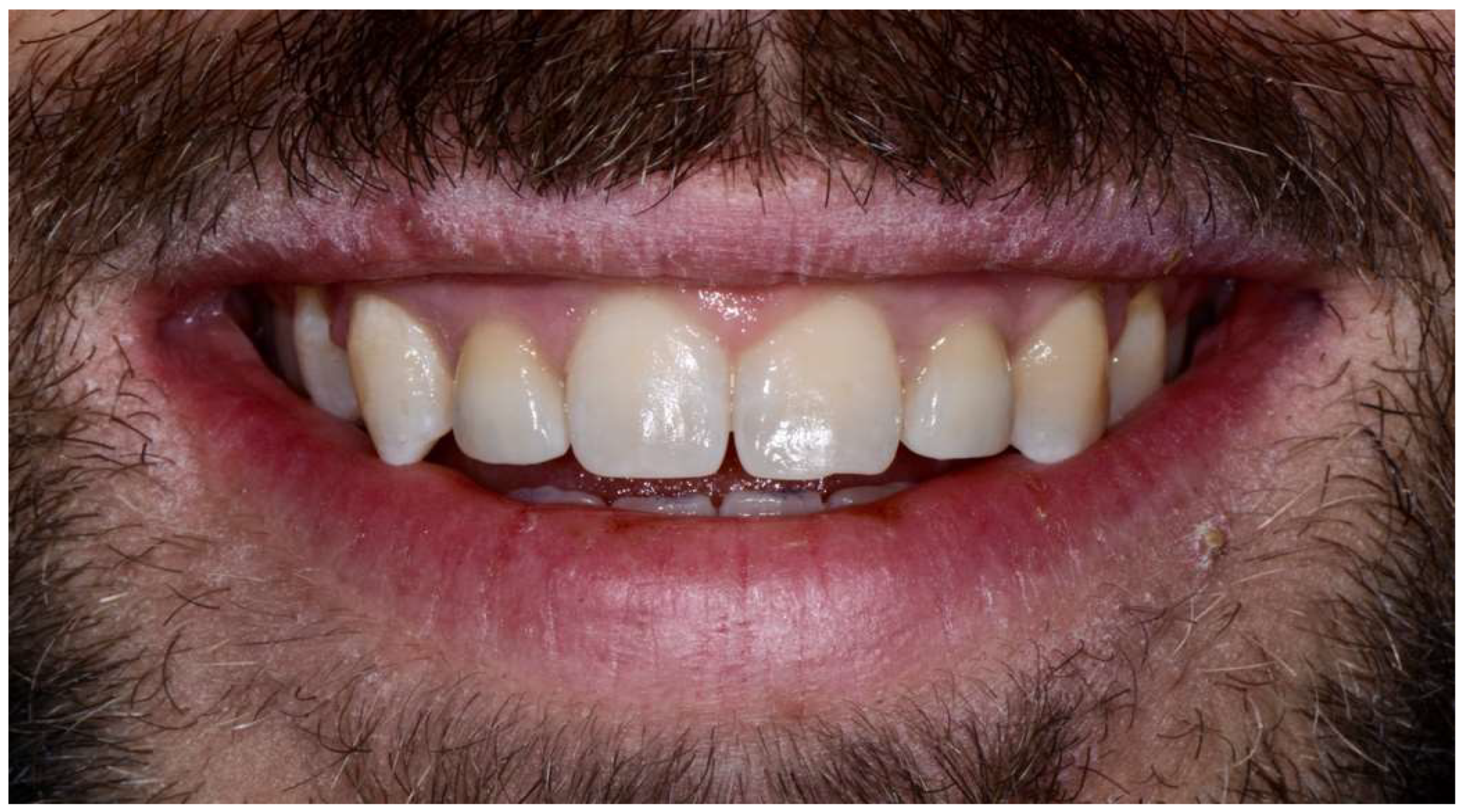 Prosthesis 06 00057 g009 Prosthesis 06 00057 g009