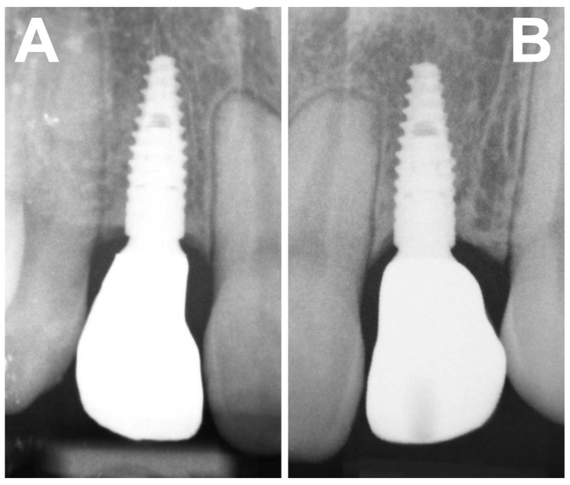 Prosthesis 06 00057 g010 Prosthesis 06 00057 g010