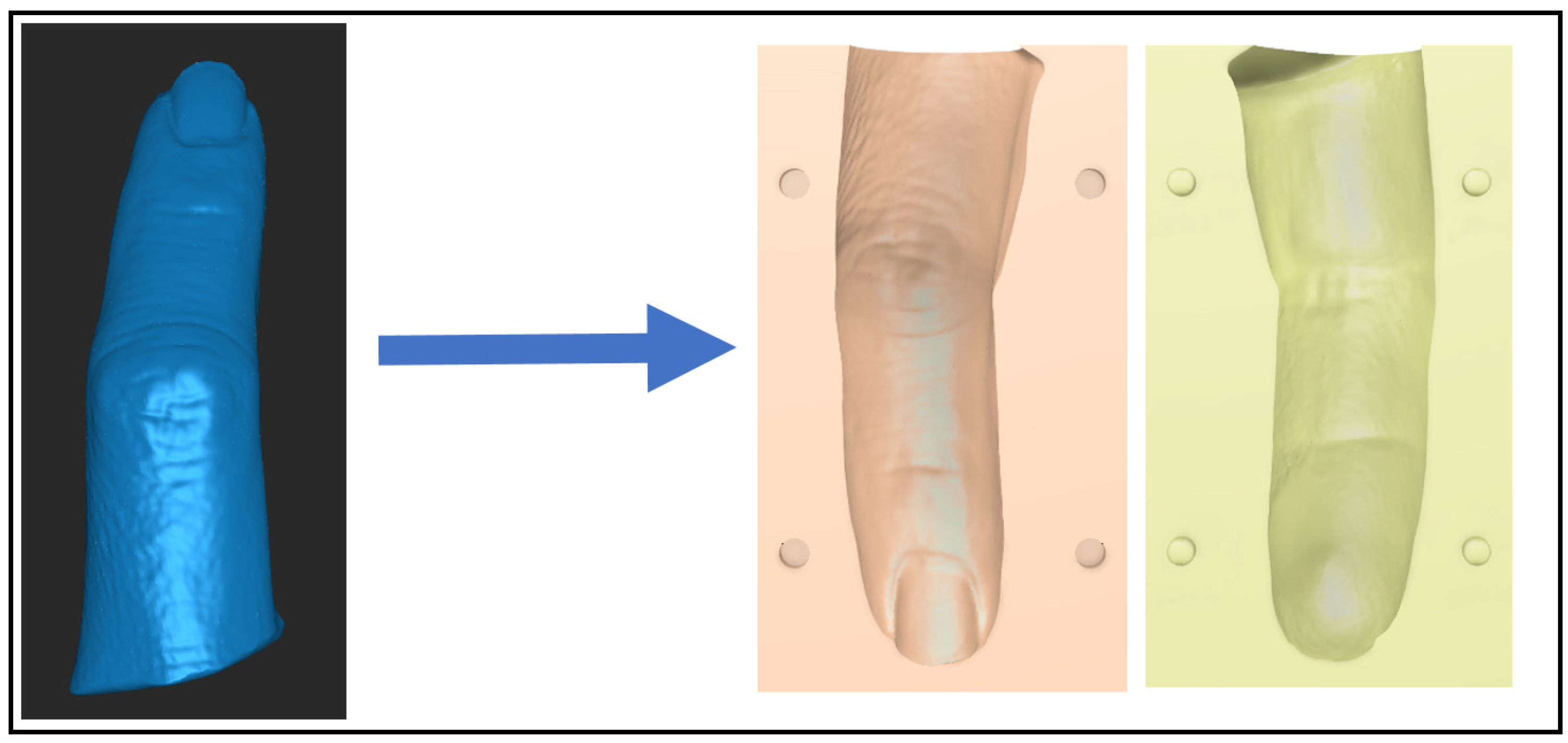 Prosthesis 06 00074 g004