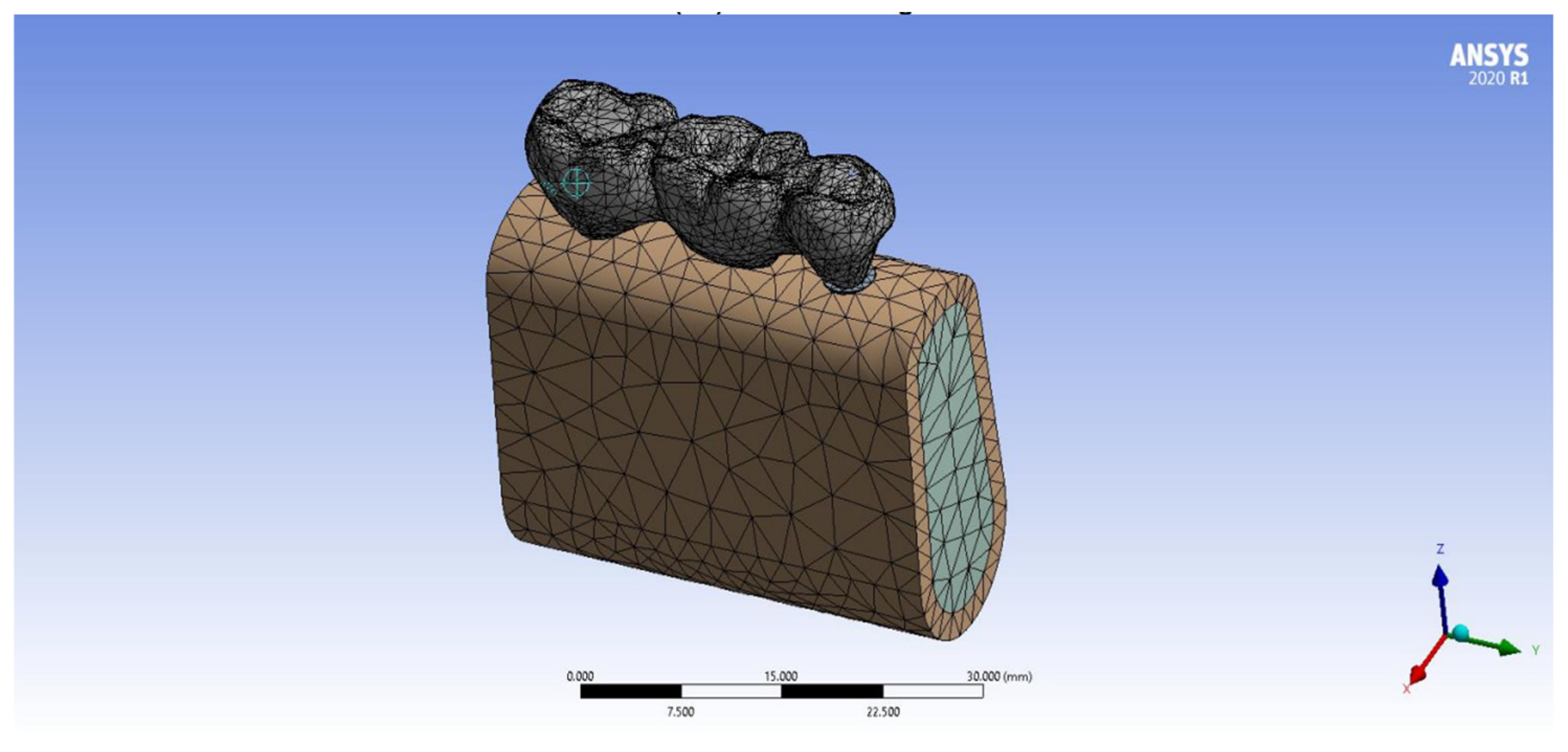 Prosthesis 06 00082 g004