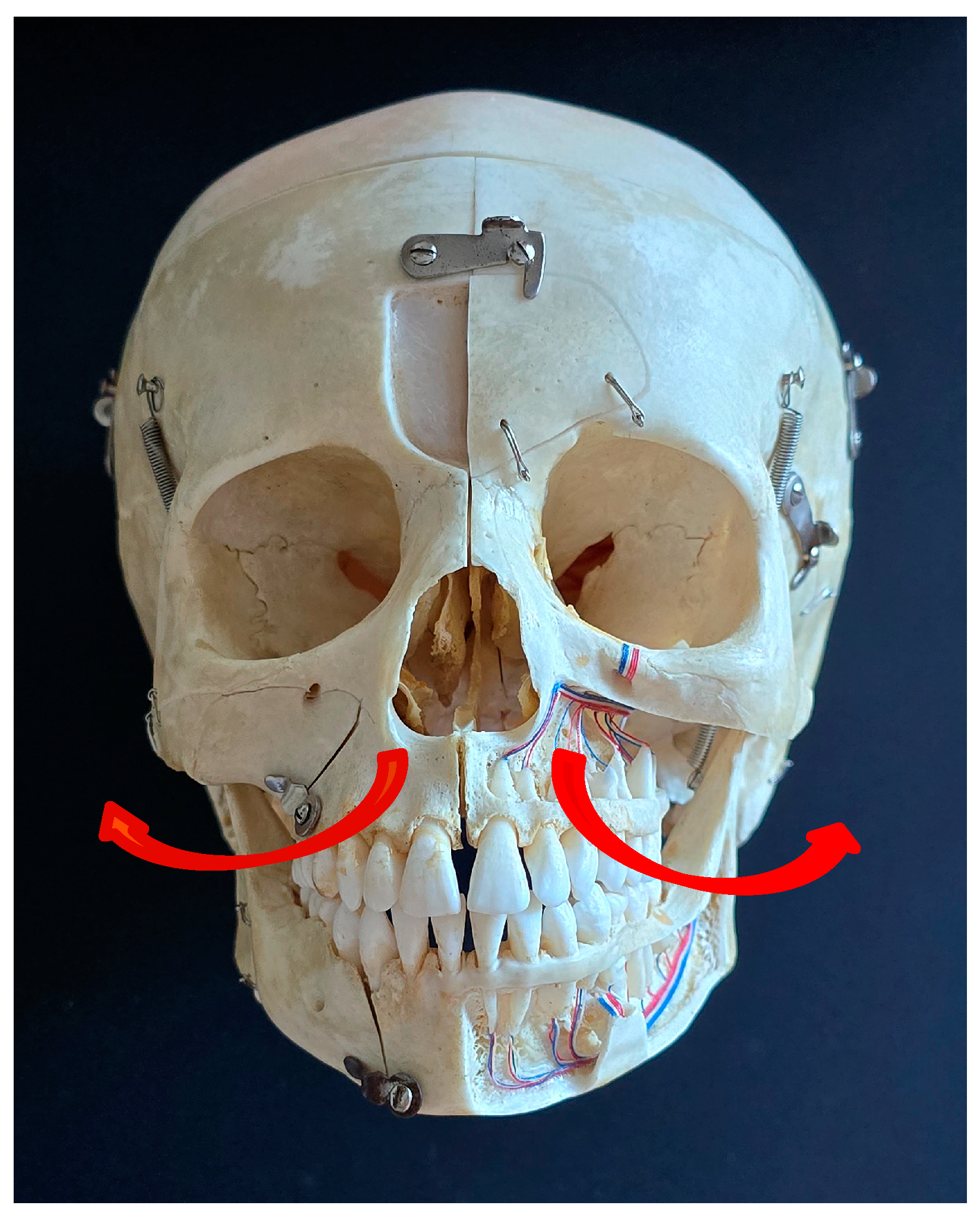 Craniosacral Breathing in a Removable Partial Denture: A
