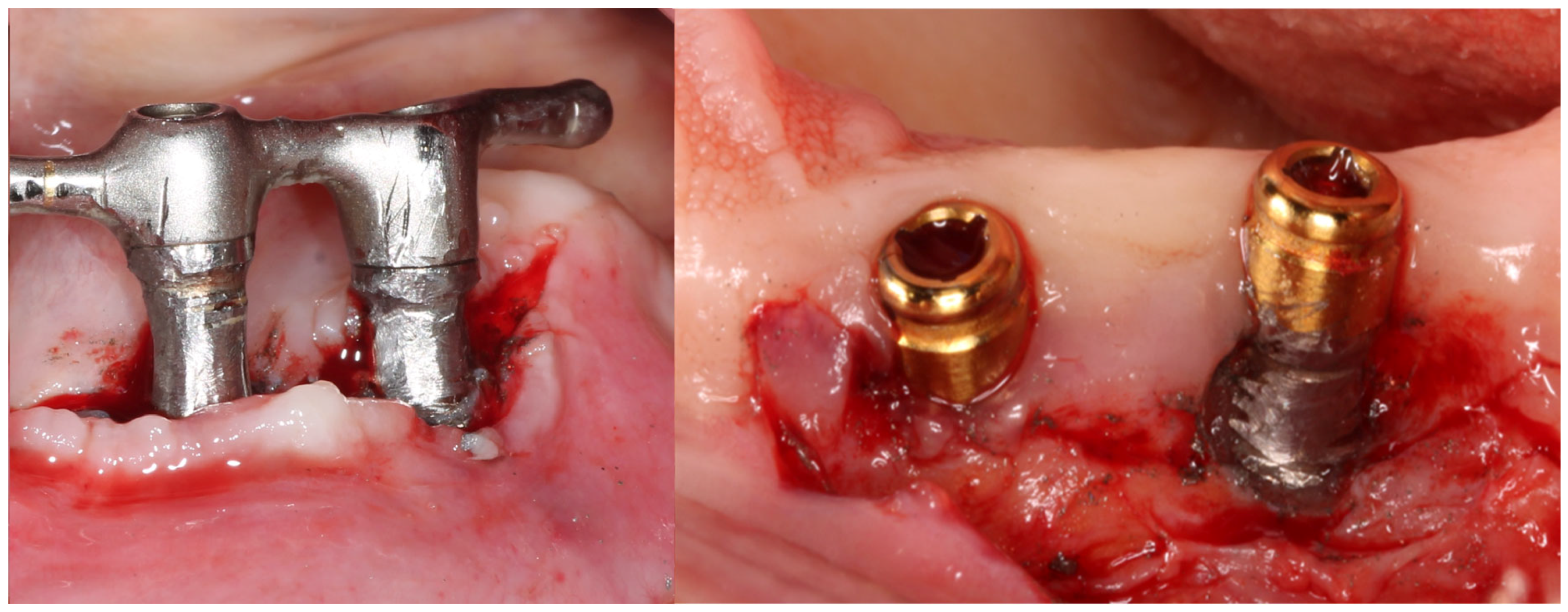 Prosthesis 06 00087 g001