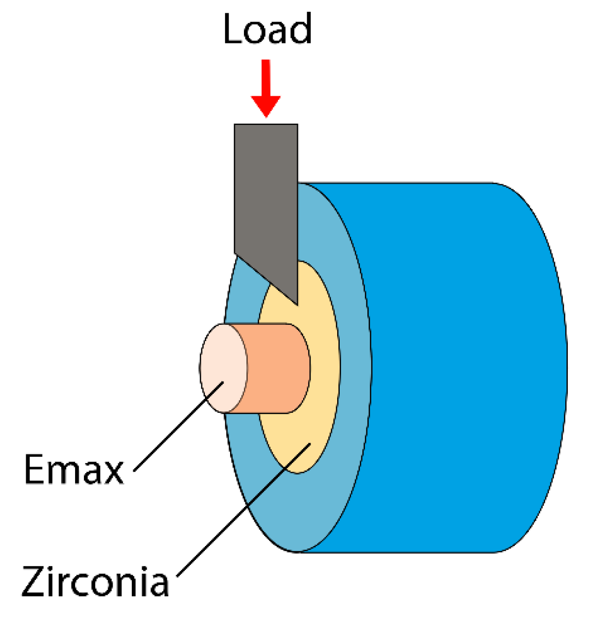 Prosthesis 06 00088 g002