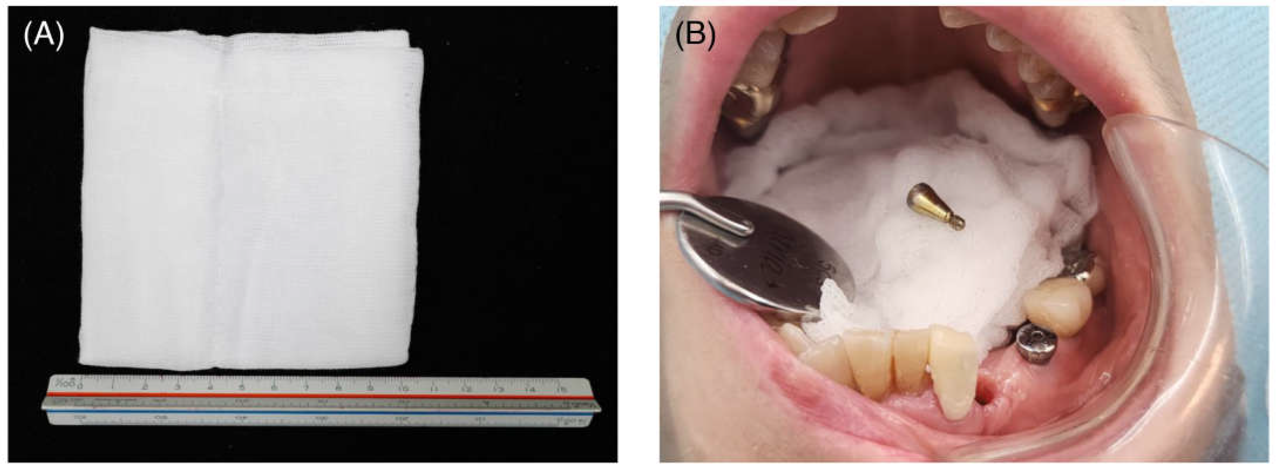 Prosthesis 06 00090 g001