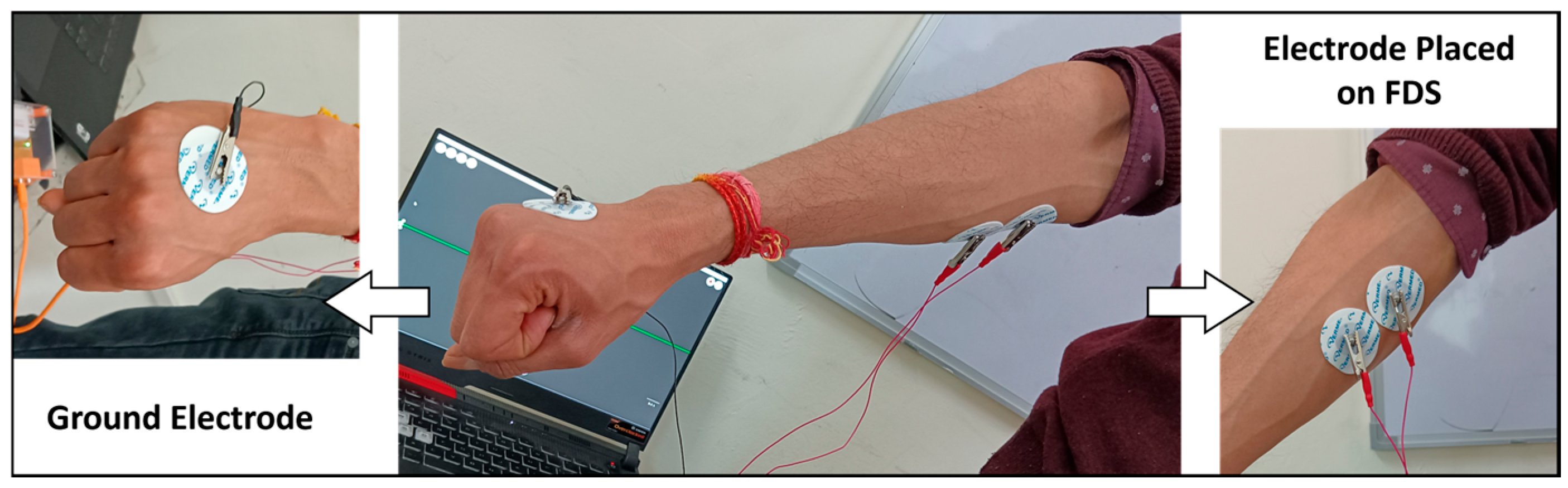 Prosthesis 06 00106 g005