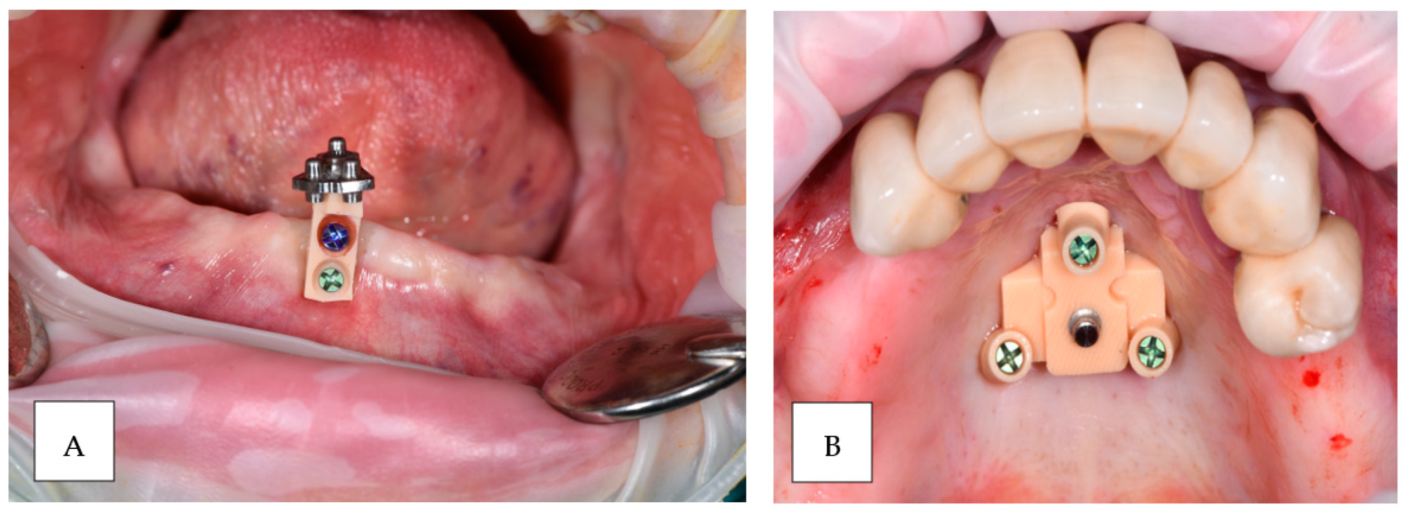 Prosthesis 06 00107 g005