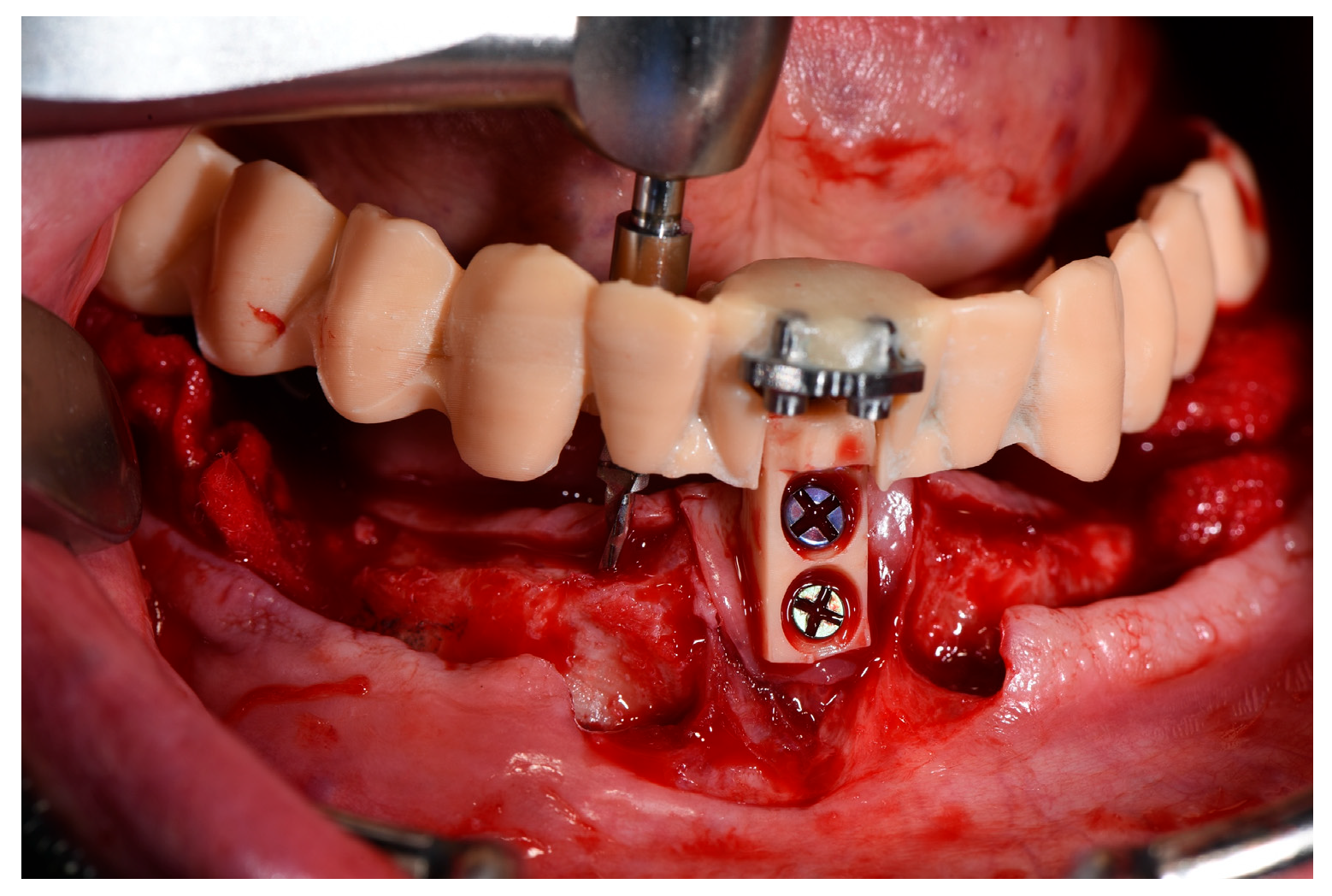 Prosthesis 06 00107 g006