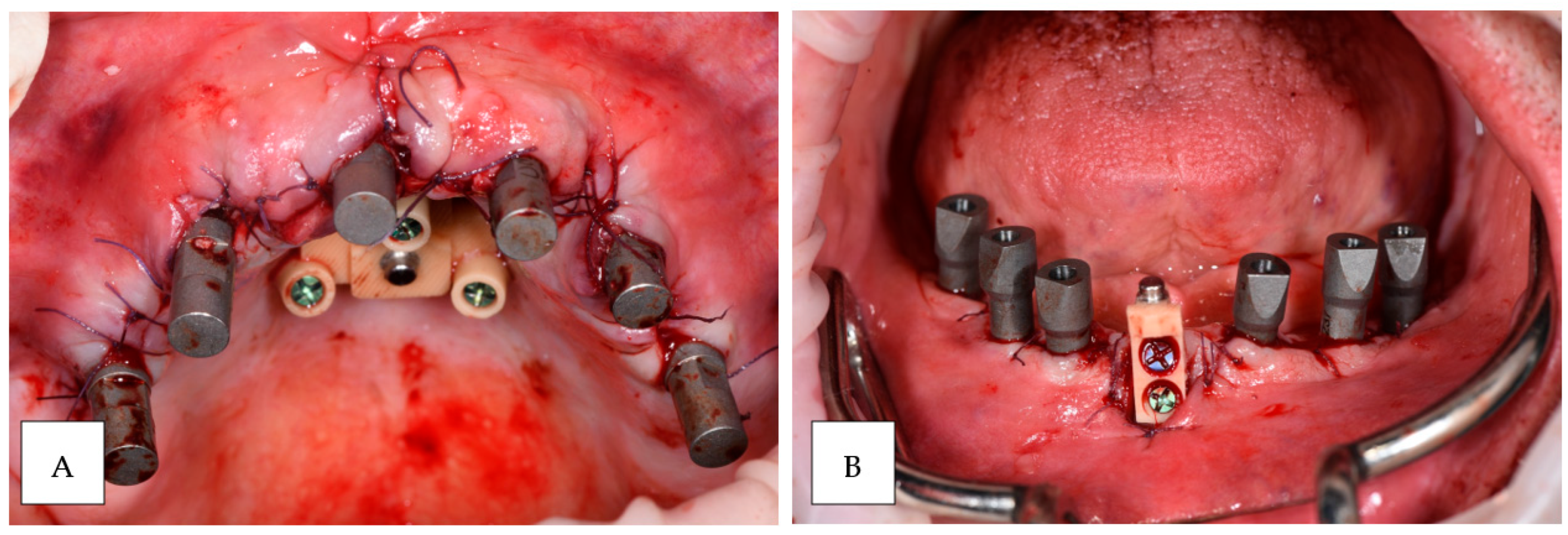 Prosthesis 06 00107 g007