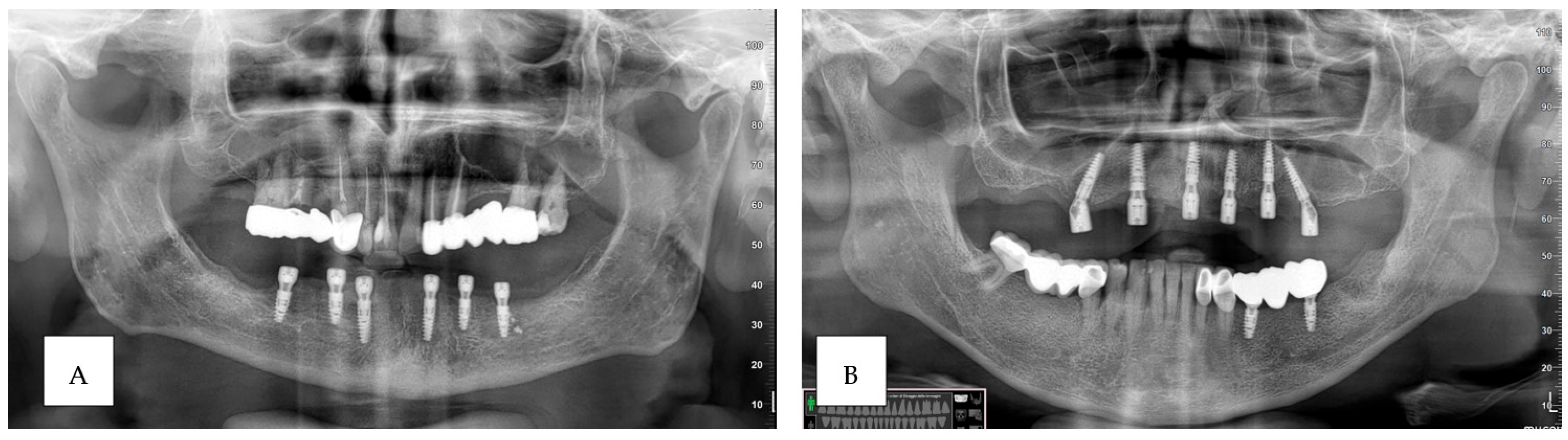 Prosthesis 06 00107 g008