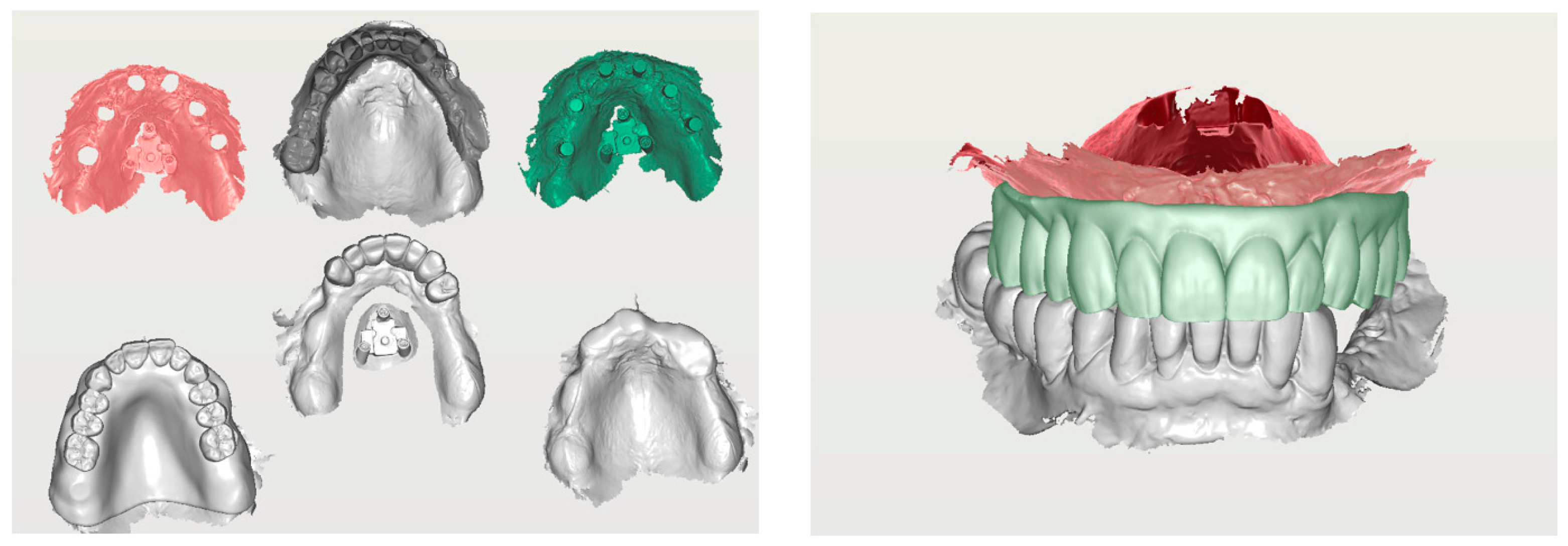 Prosthesis 06 00107 g009
