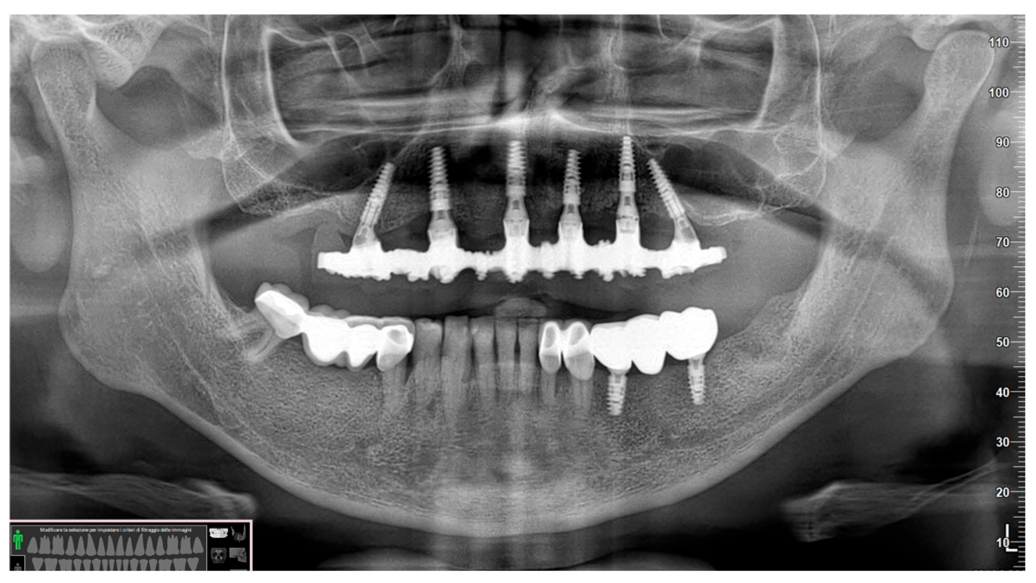 Prosthesis 06 00107 g012