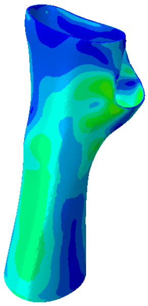 Prosthesis 06 00109 i012