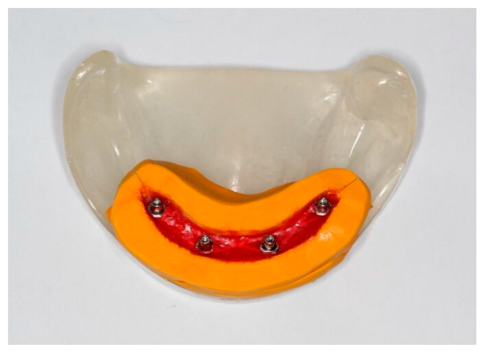 Prosthesis 06 00113 g004