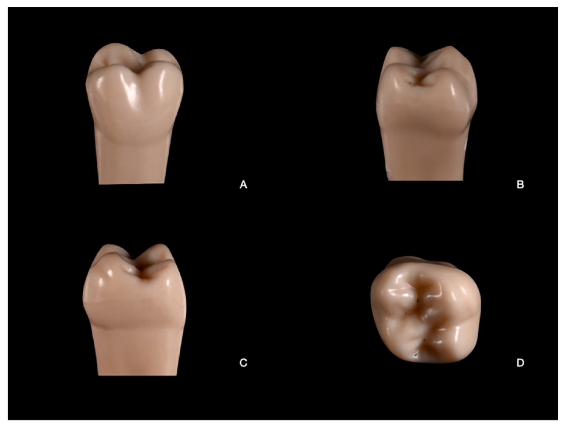 Prosthesis 07 00005 g002 Prosthesis 07 00005 g002