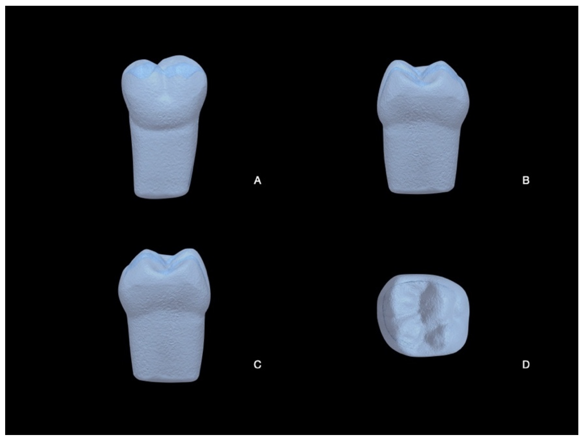 Prosthesis 07 00005 g003 Prosthesis 07 00005 g003