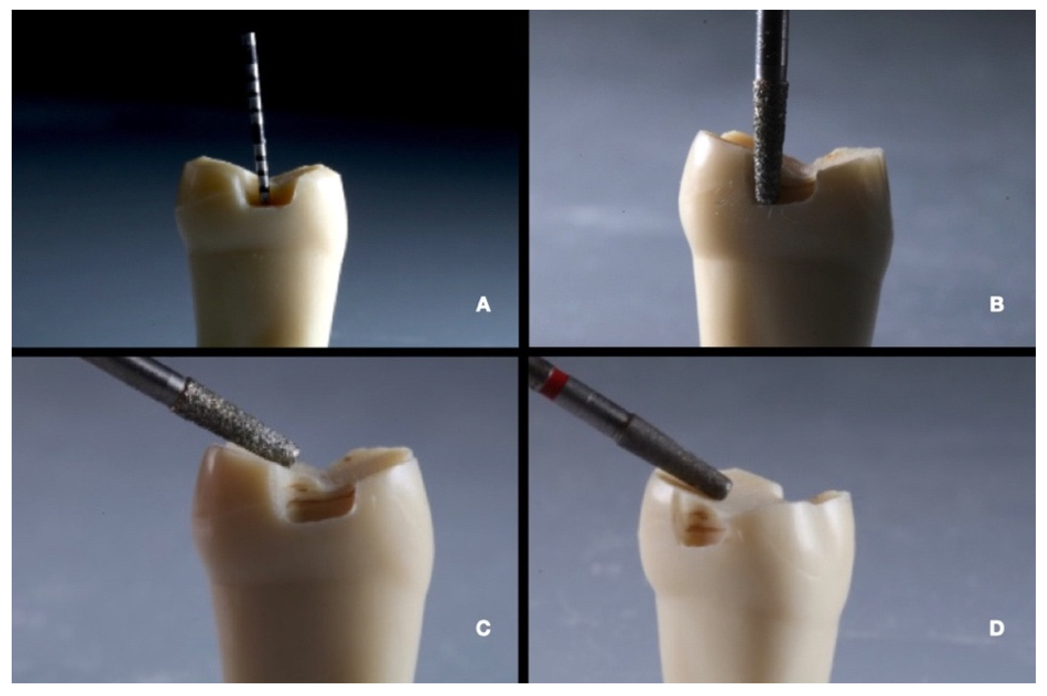 Prosthesis 07 00005 g005 Prosthesis 07 00005 g005