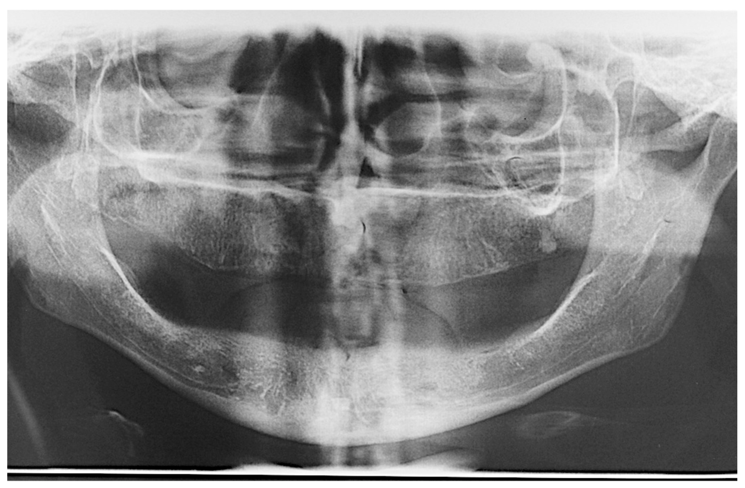 Prosthesis 07 00009 g001 Prosthesis 07 00009 g001