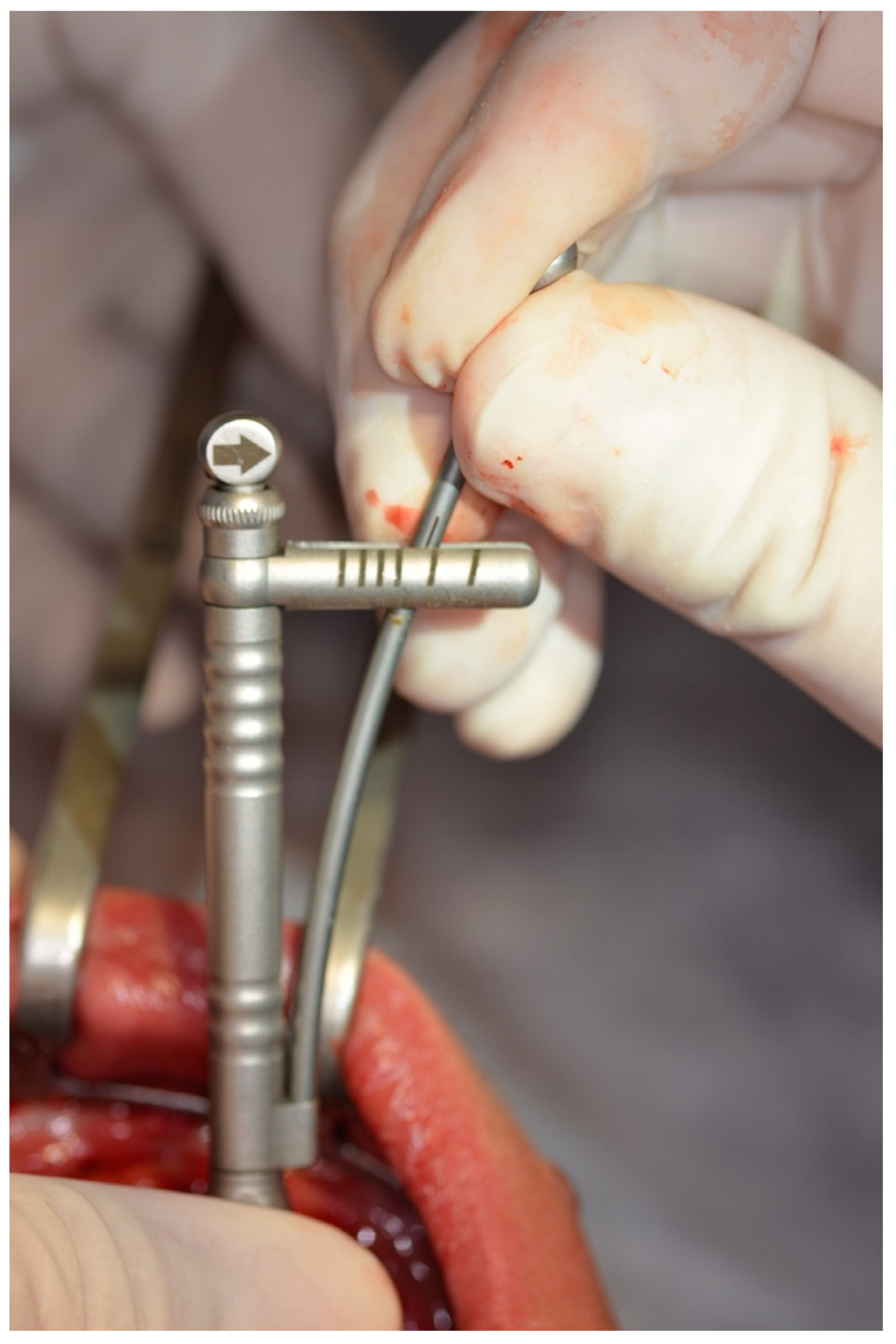 Prosthesis 07 00009 g008 Prosthesis 07 00009 g008