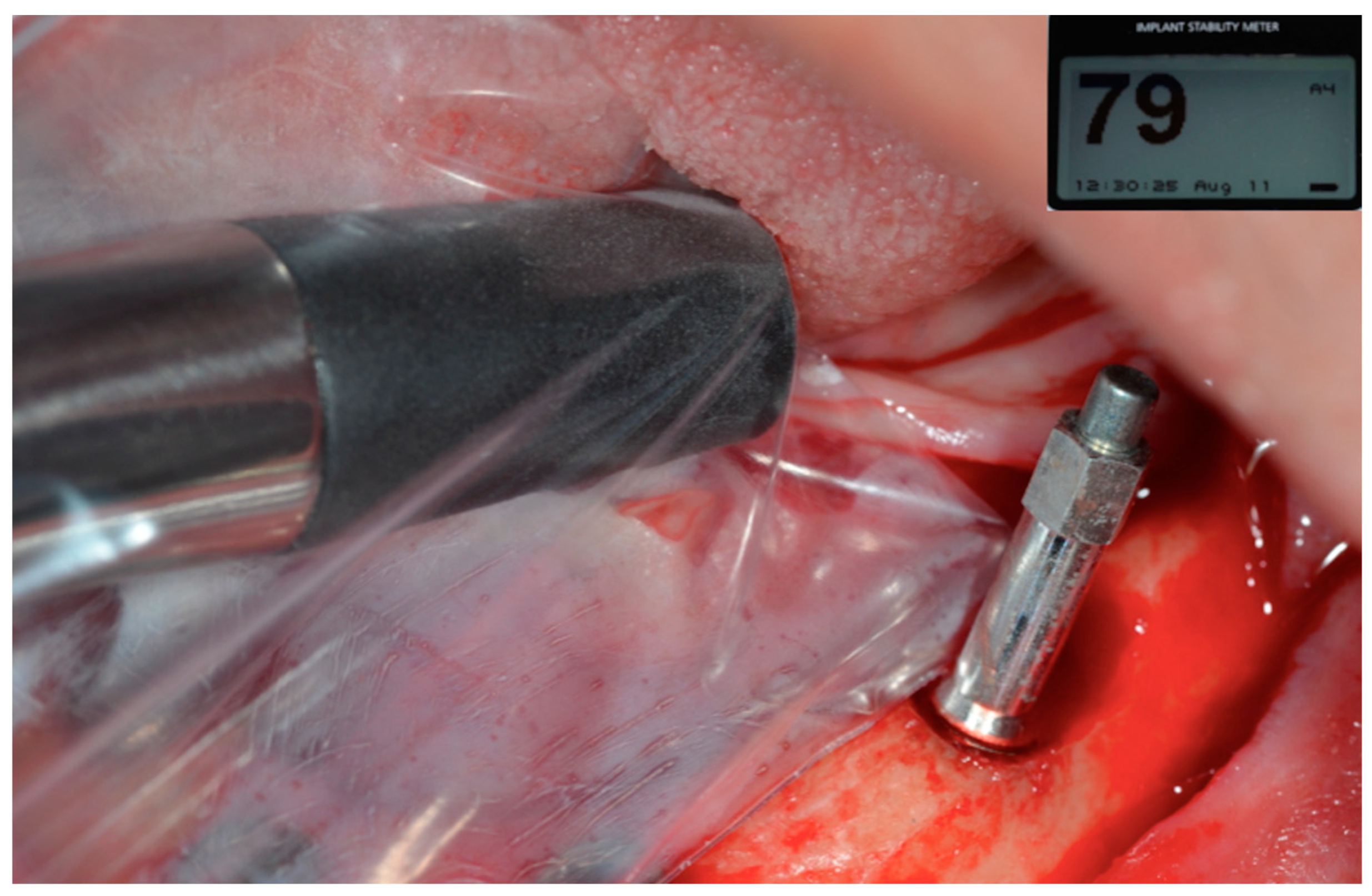 Prosthesis 07 00009 g009 Prosthesis 07 00009 g009