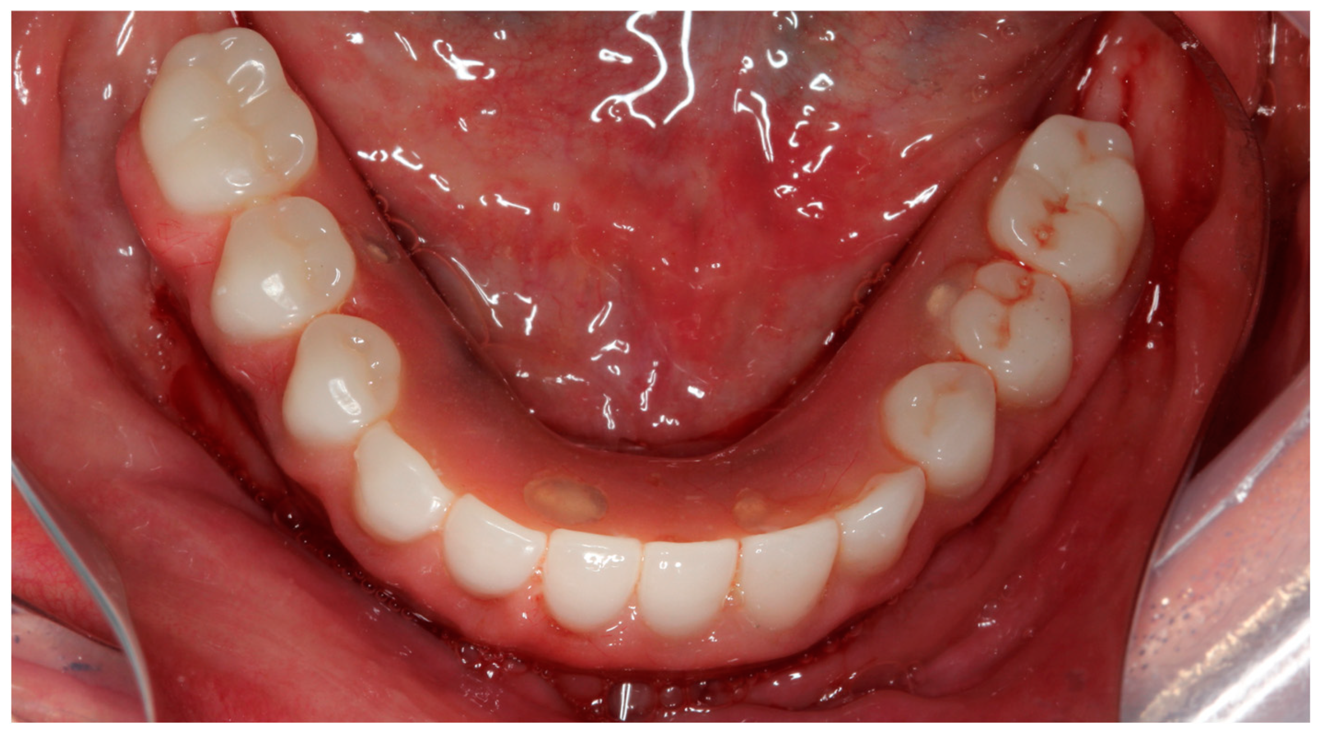 Prosthesis 07 00009 g011 Prosthesis 07 00009 g011