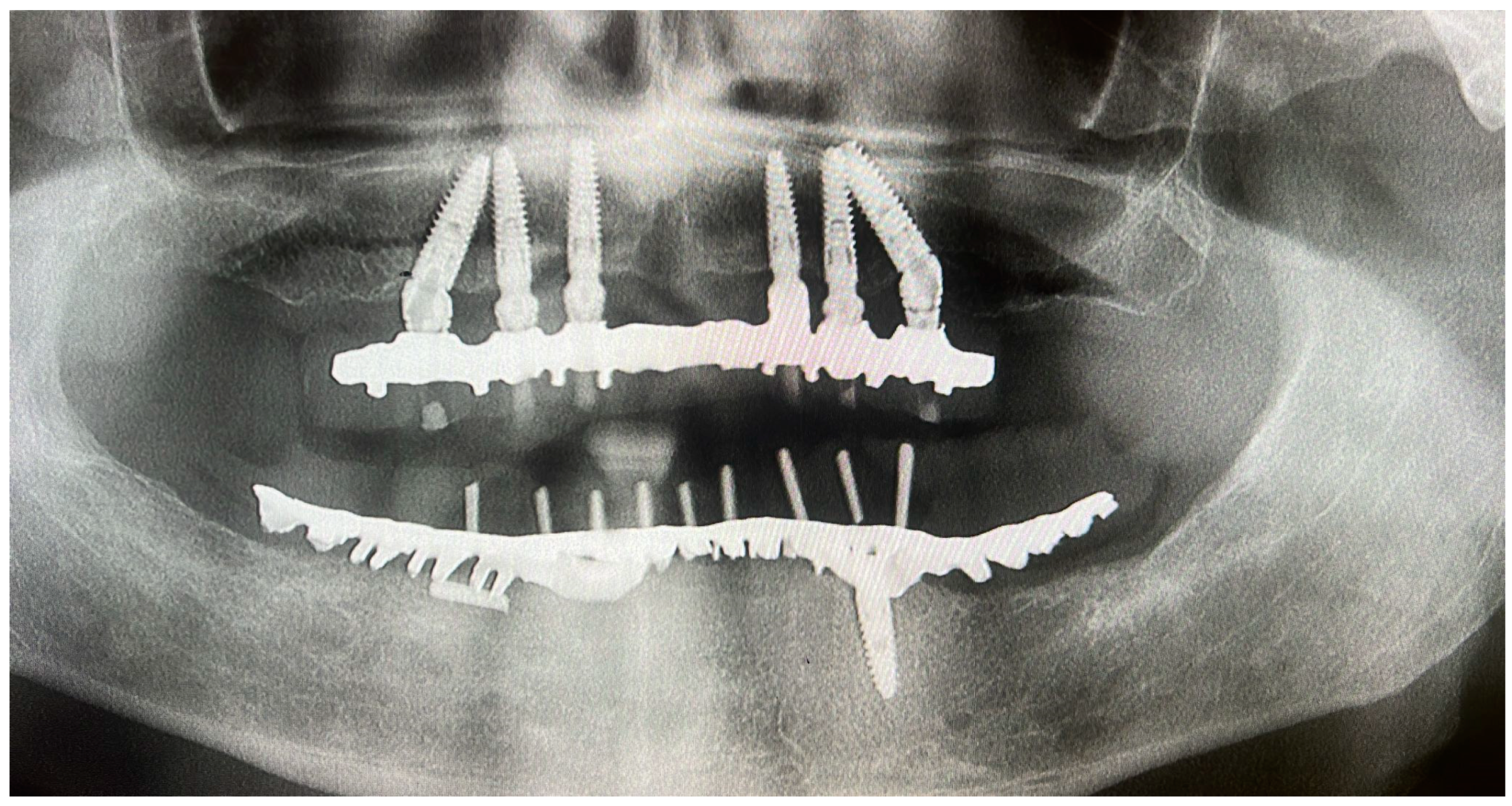 Prosthesis 07 00010 g001
