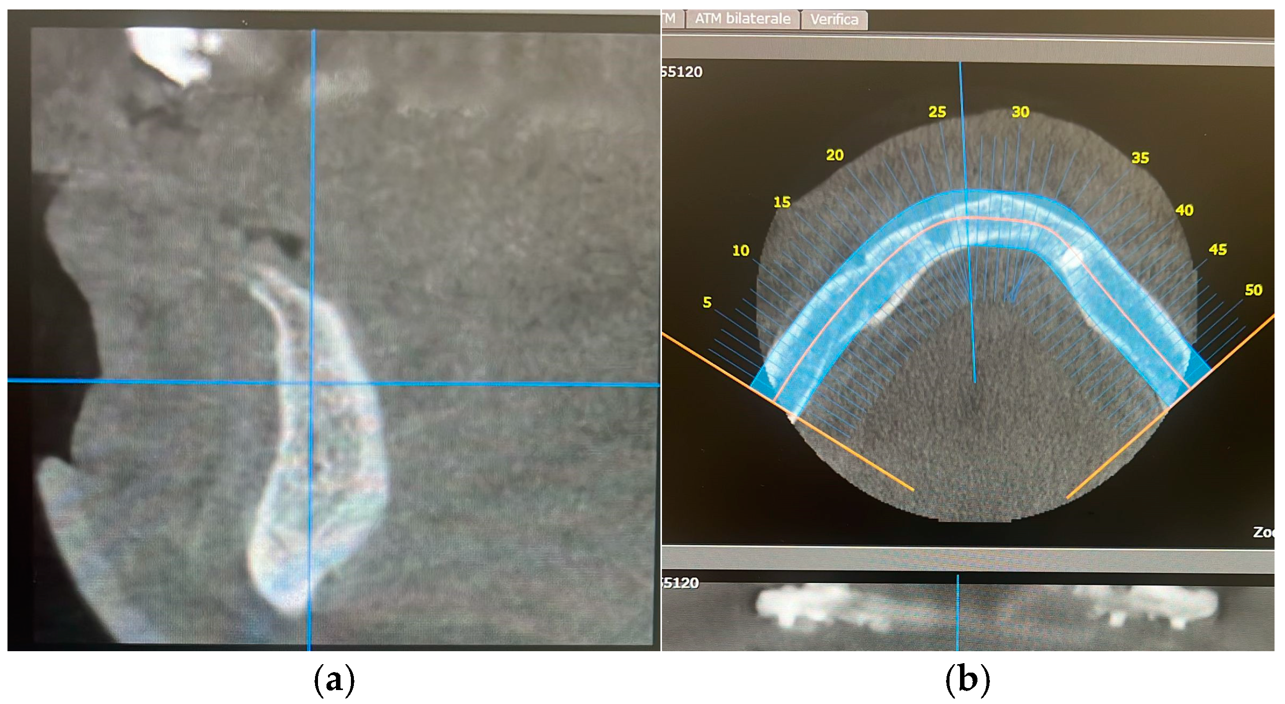 Prosthesis 07 00010 g002