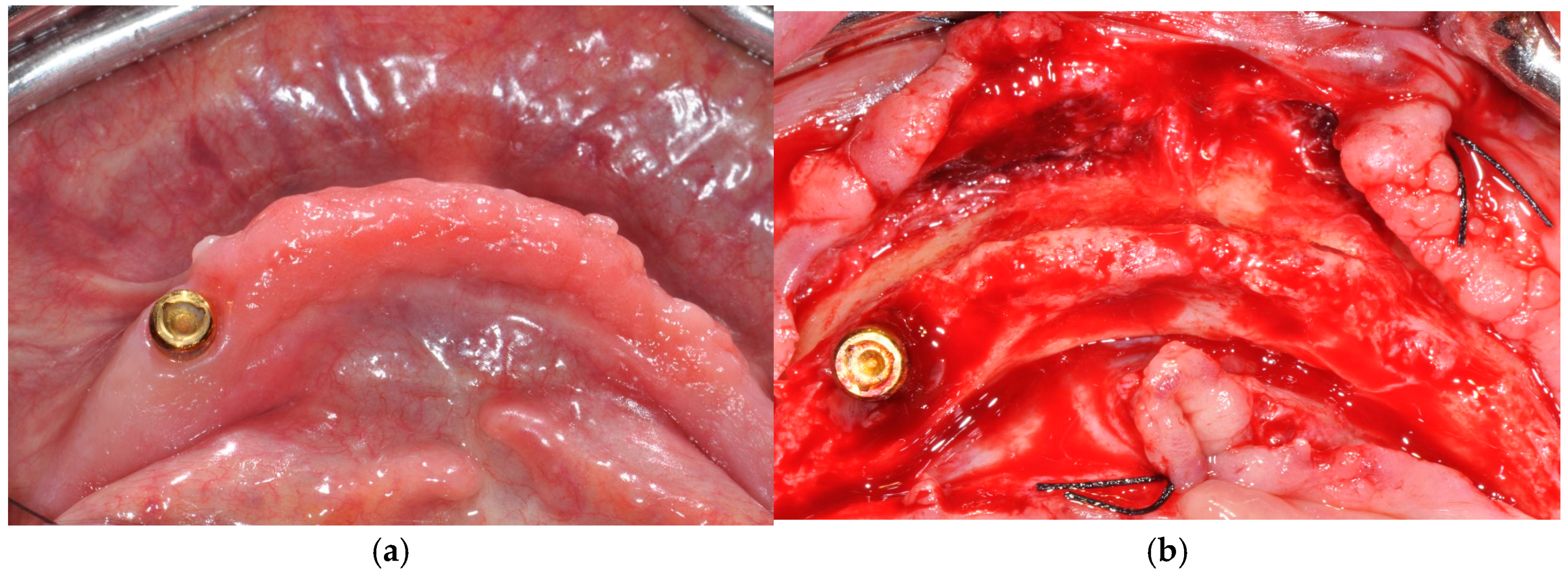 Prosthesis 07 00010 g003