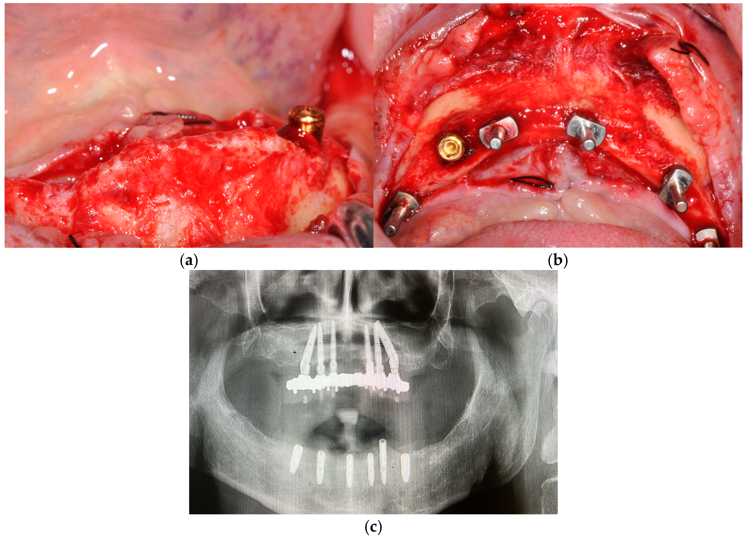 Prosthesis 07 00010 g004