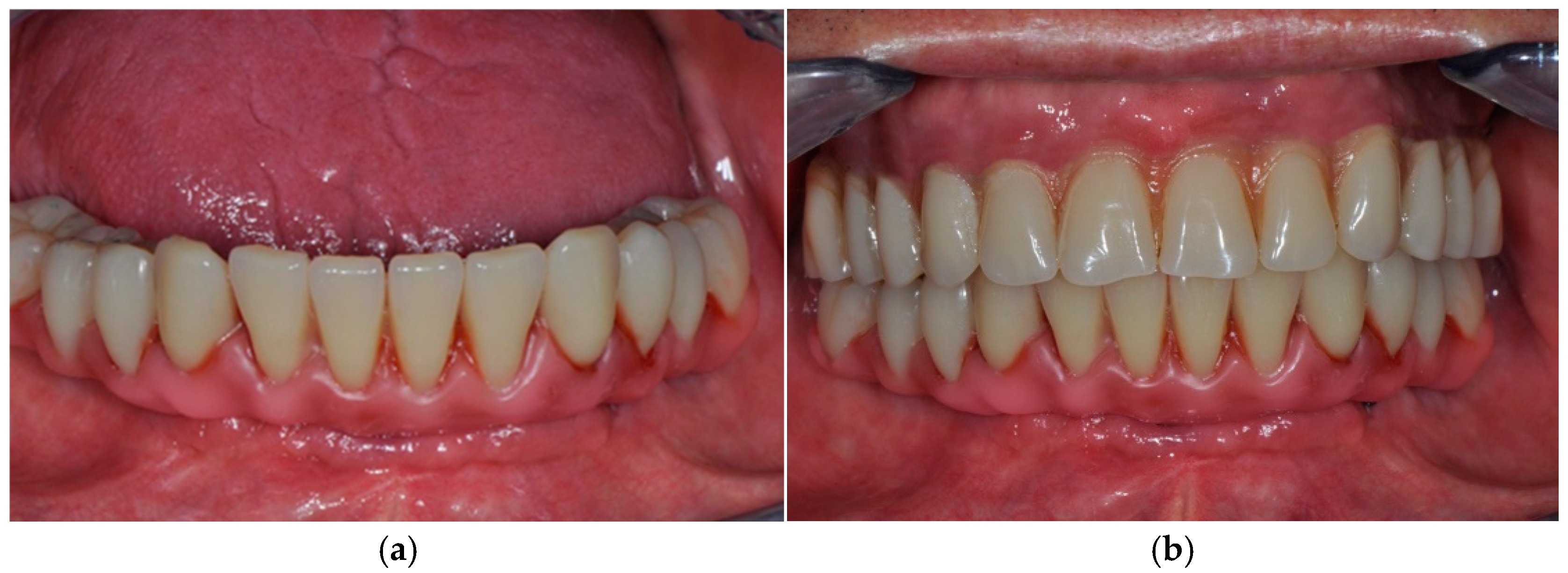 Prosthesis 07 00010 g005