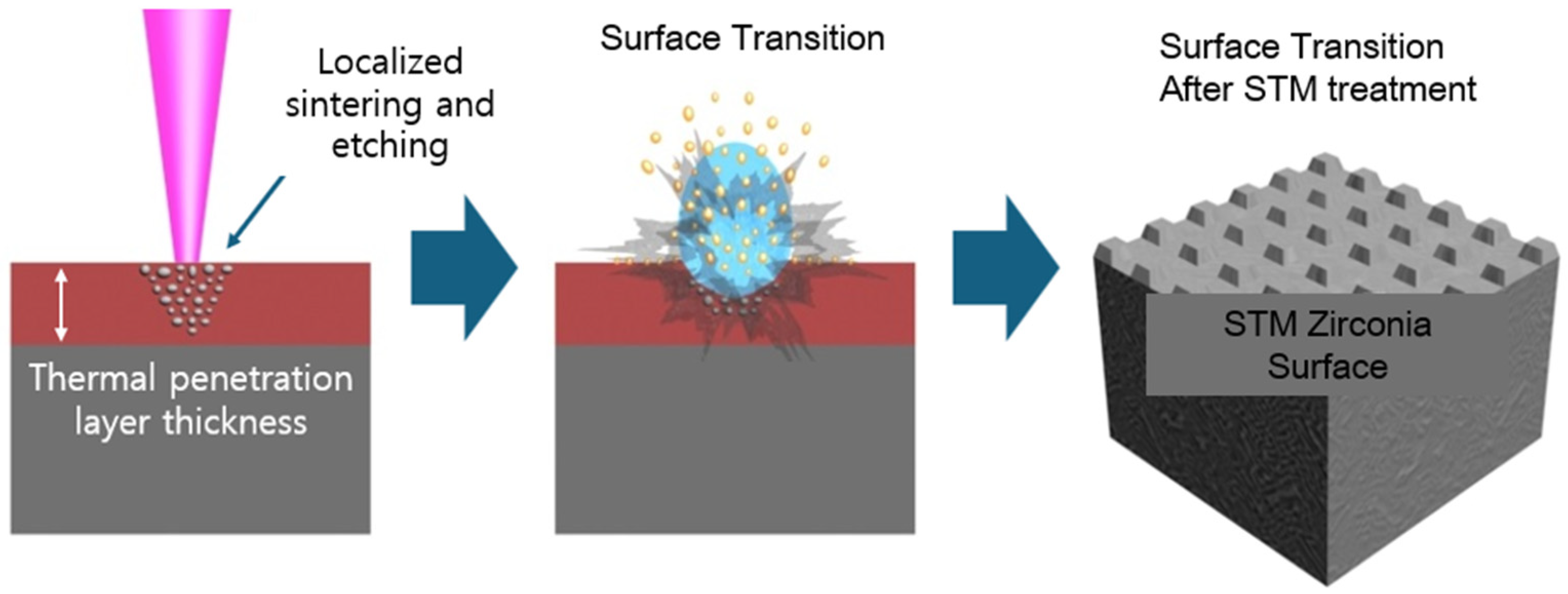 Prosthesis 07 00019 g001