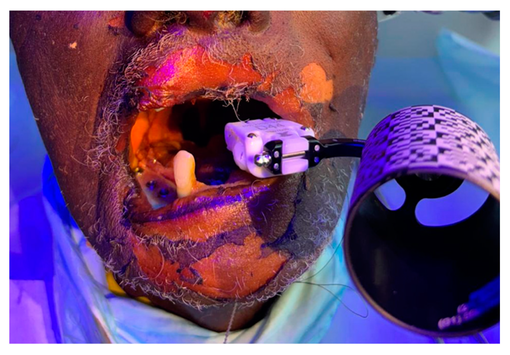 Prosthesis 07 00020 g001