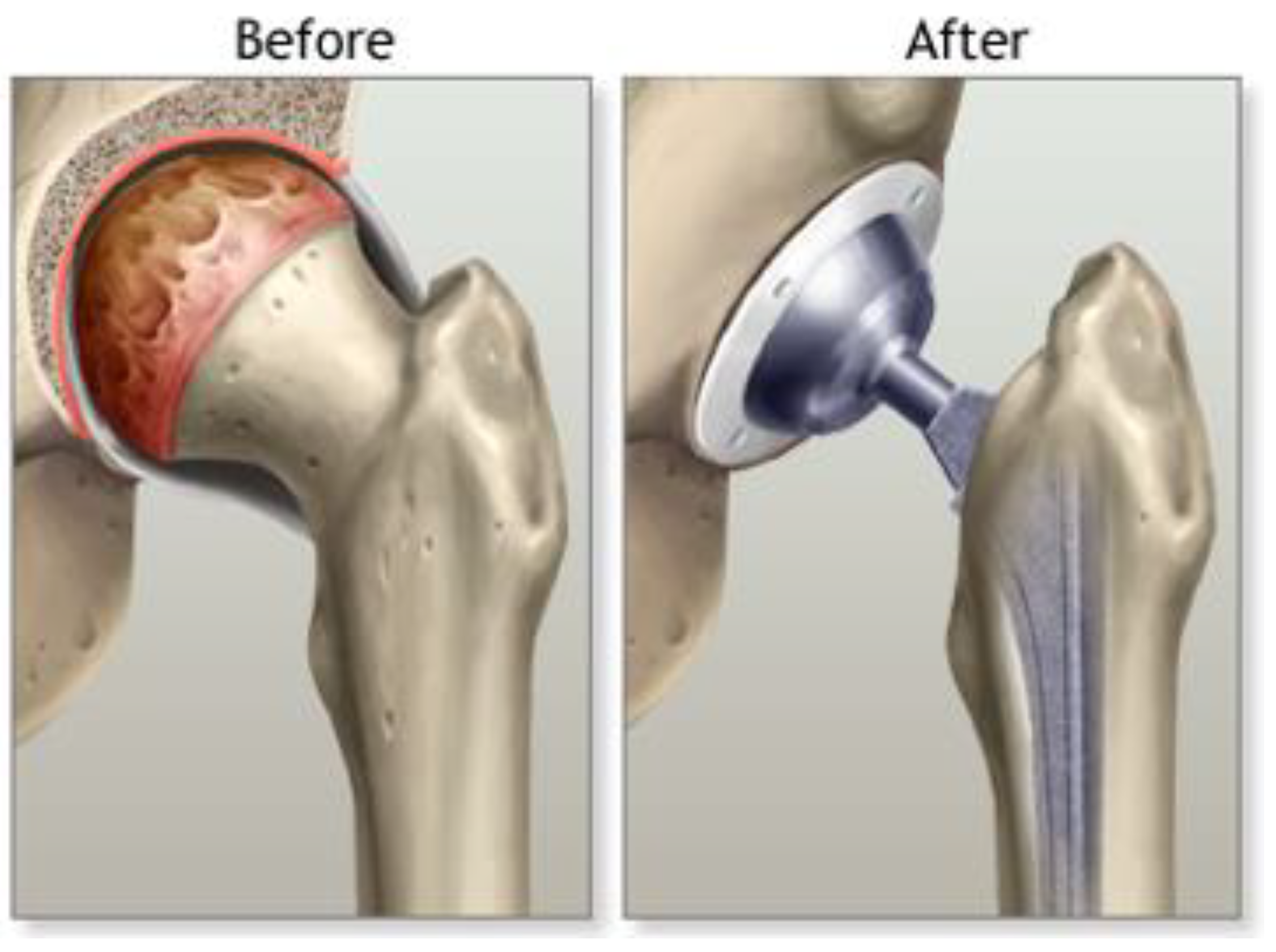 Prosthesis 07 00021 g001