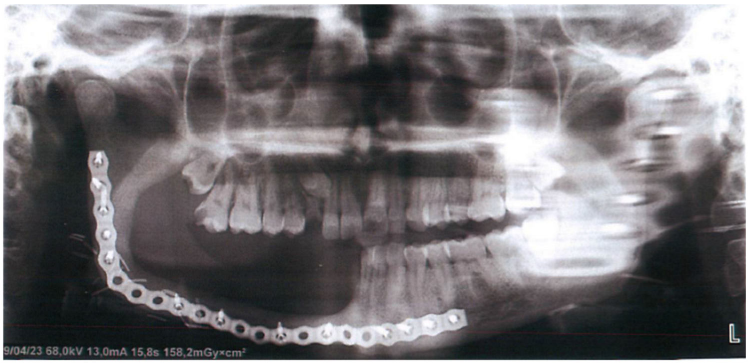 Prosthesis 07 00022 g001