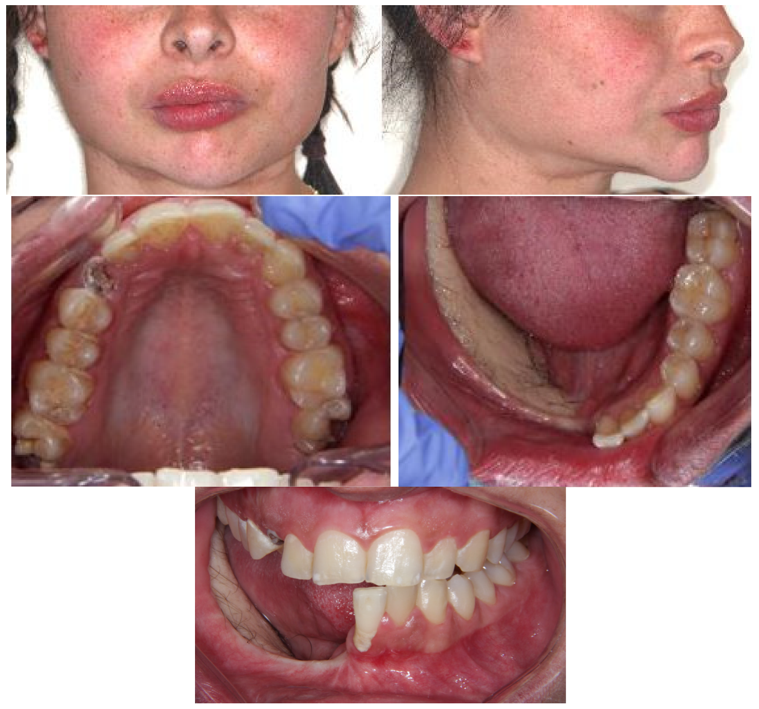 Prosthesis 07 00022 g002