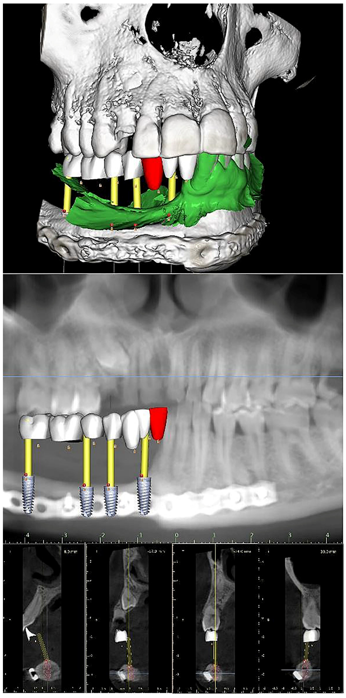 Prosthesis 07 00022 g004