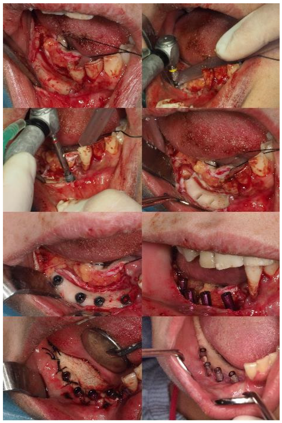 Prosthesis 07 00022 g005