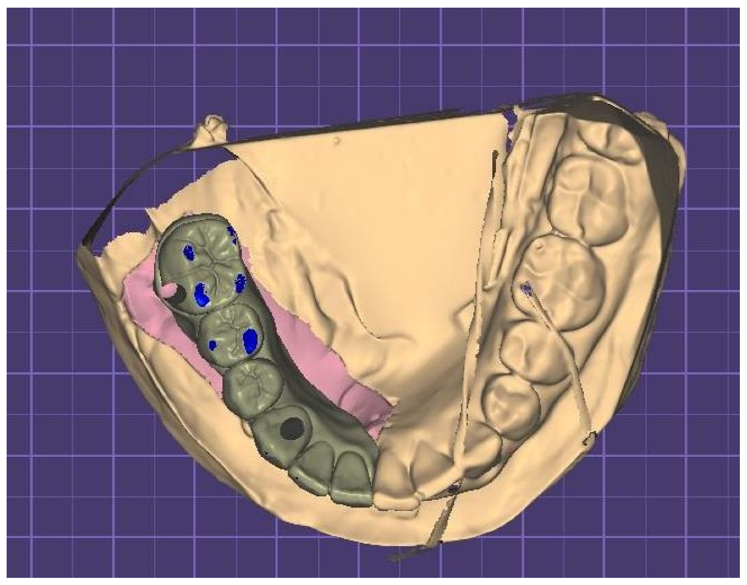 Prosthesis 07 00022 g008