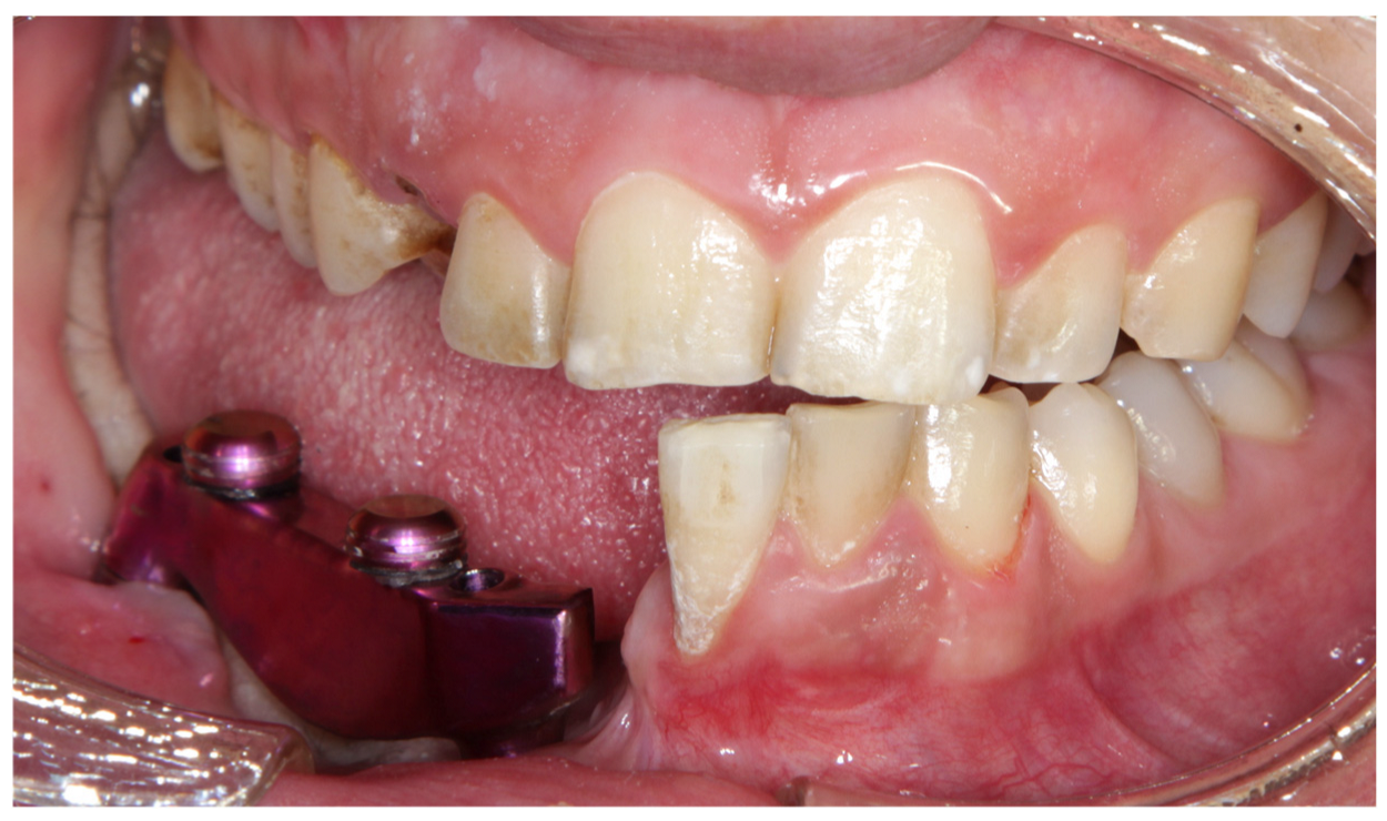 Prosthesis 07 00022 g011