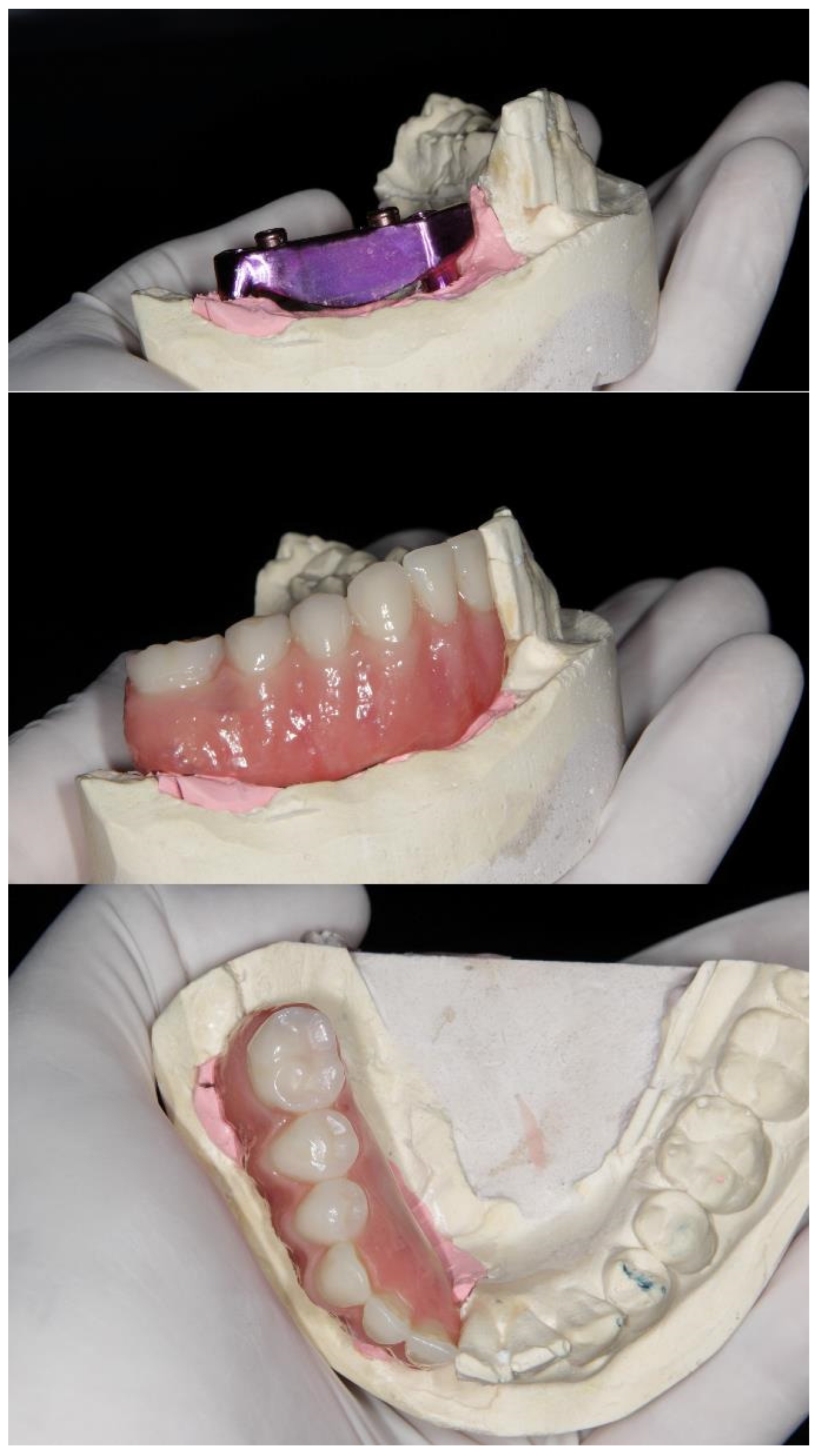 Prosthesis 07 00022 g012