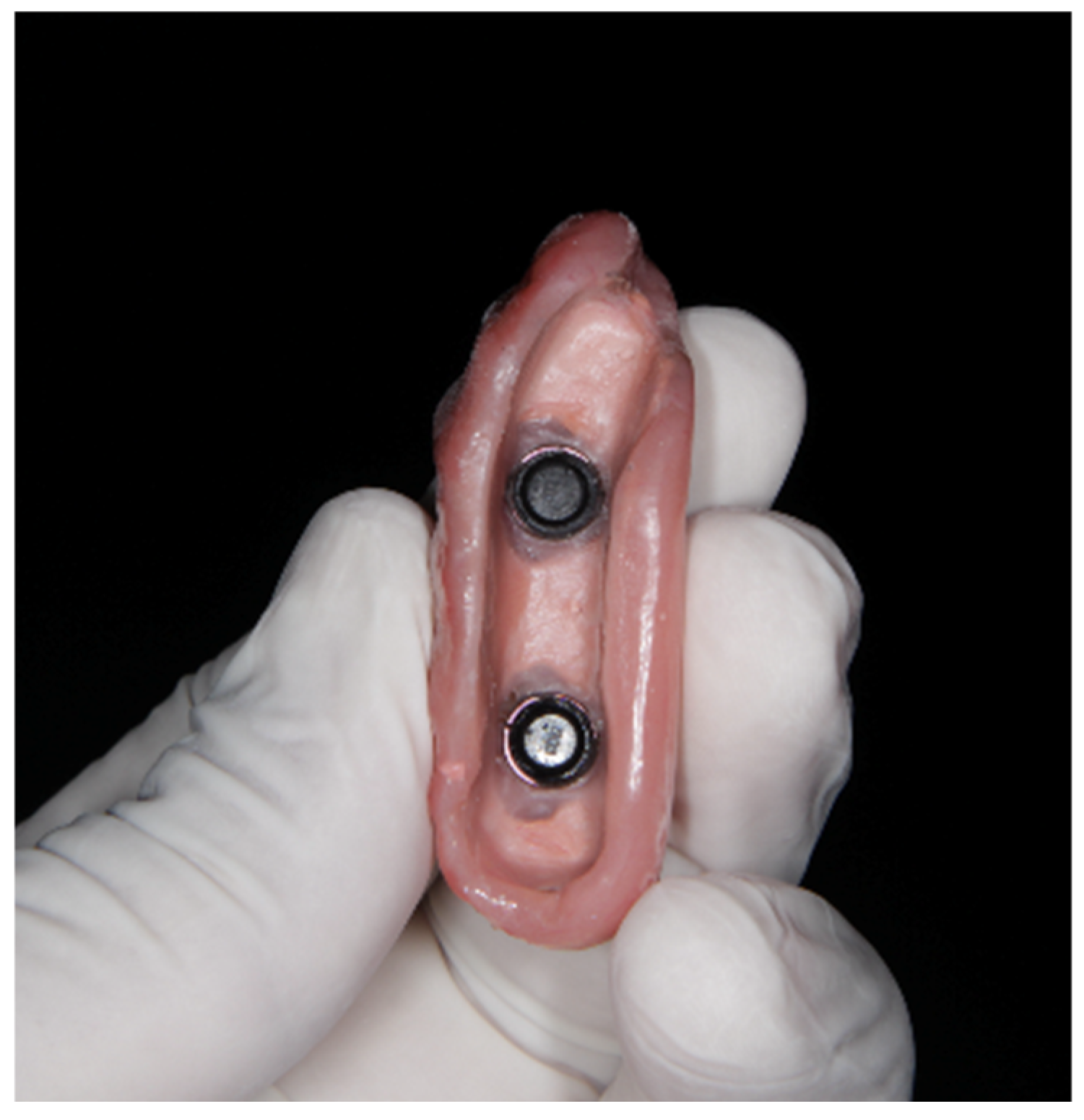 Prosthesis 07 00022 g013