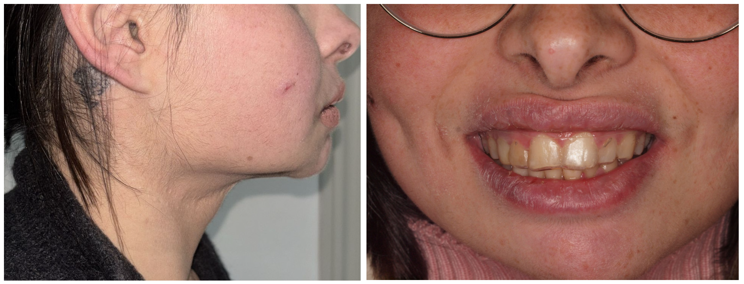 Prosthesis 07 00022 g018