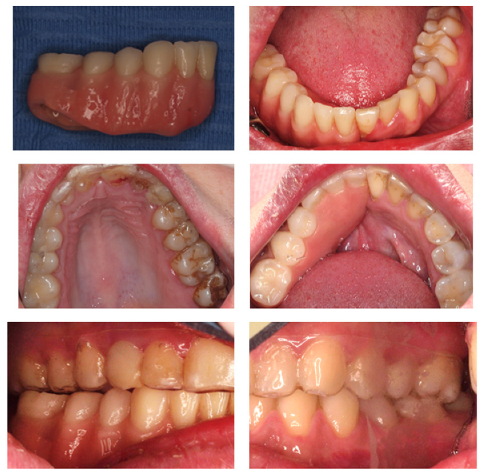 Prosthesis 07 00022 g019