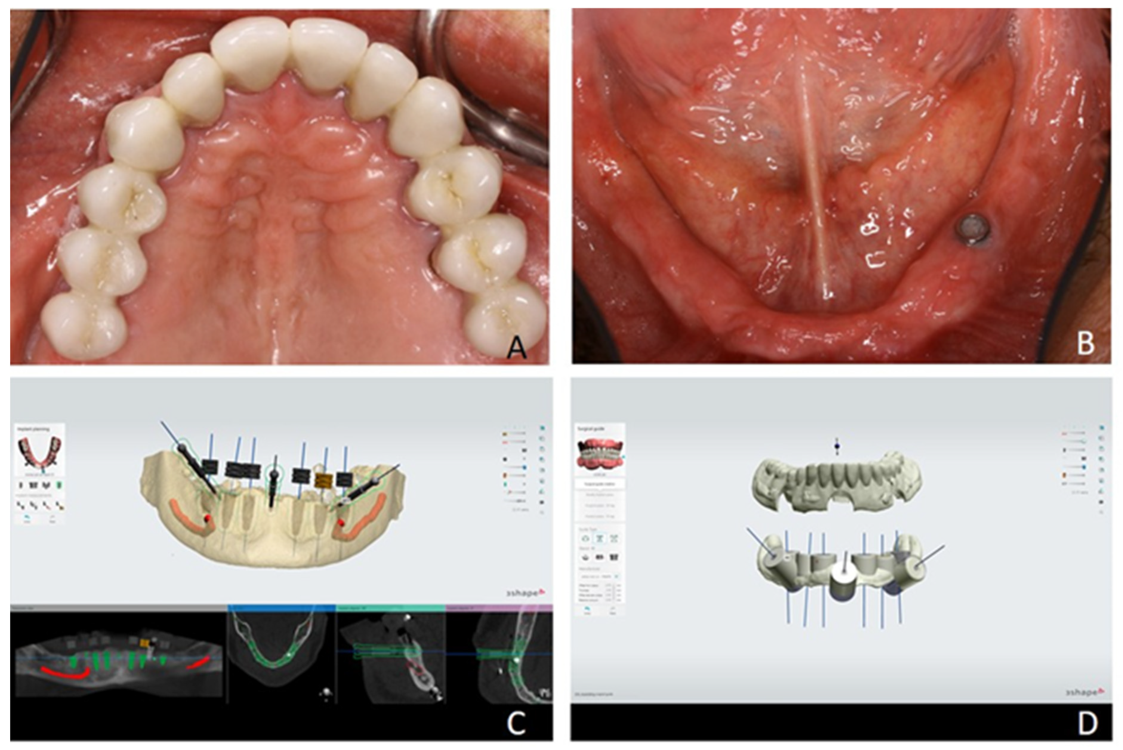 Prosthesis 07 00025 g003