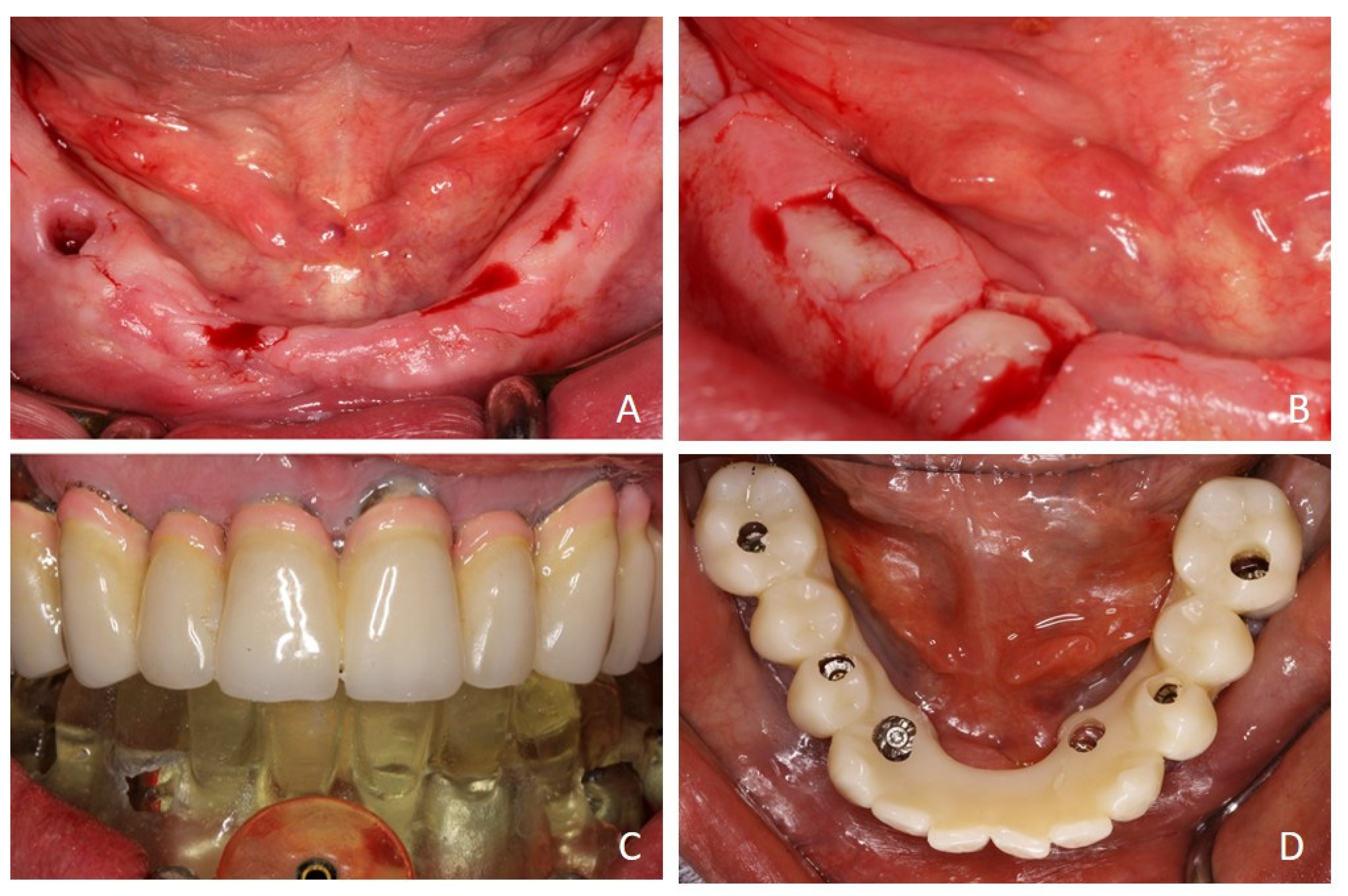 Prosthesis 07 00025 g005