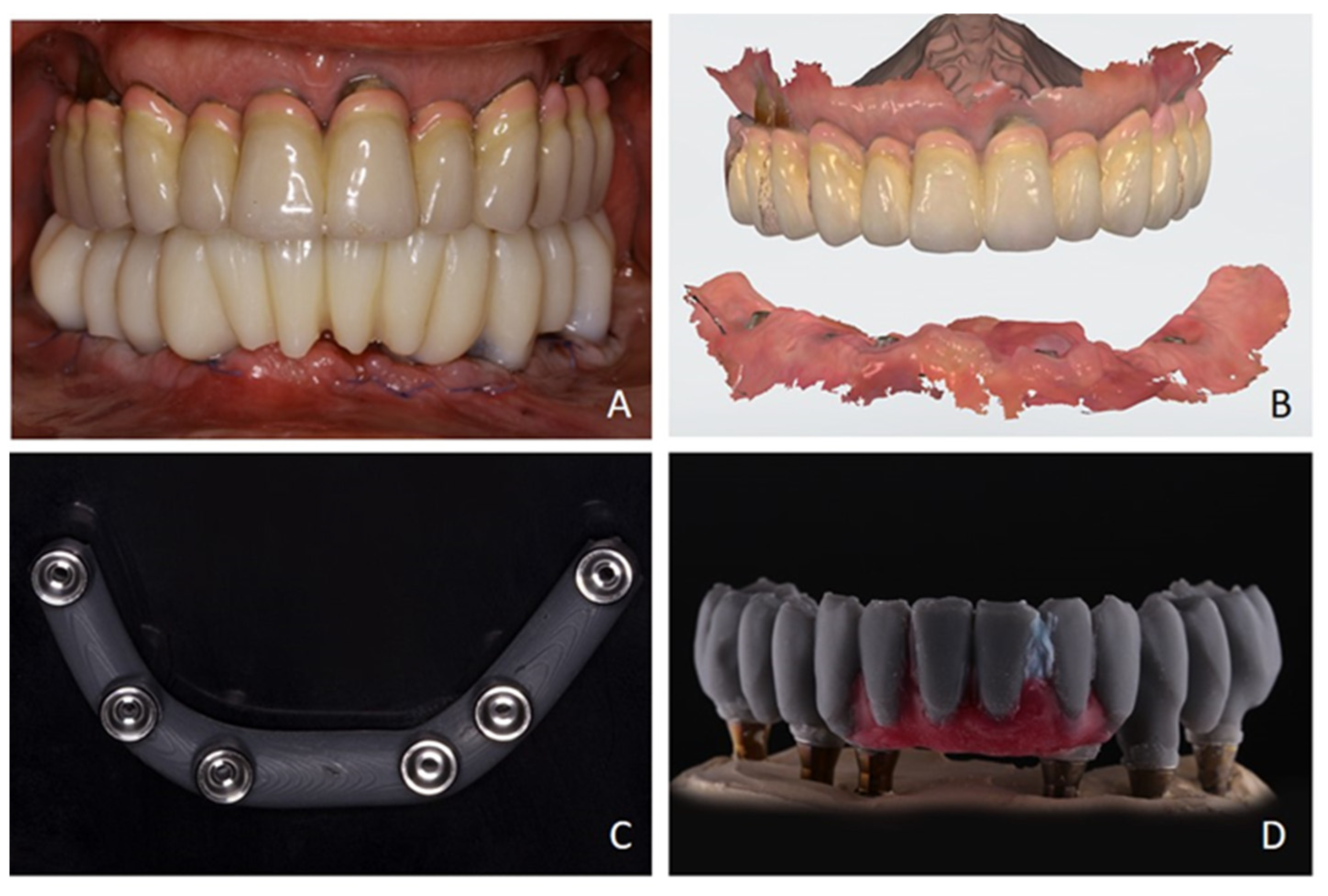 Prosthesis 07 00025 g006