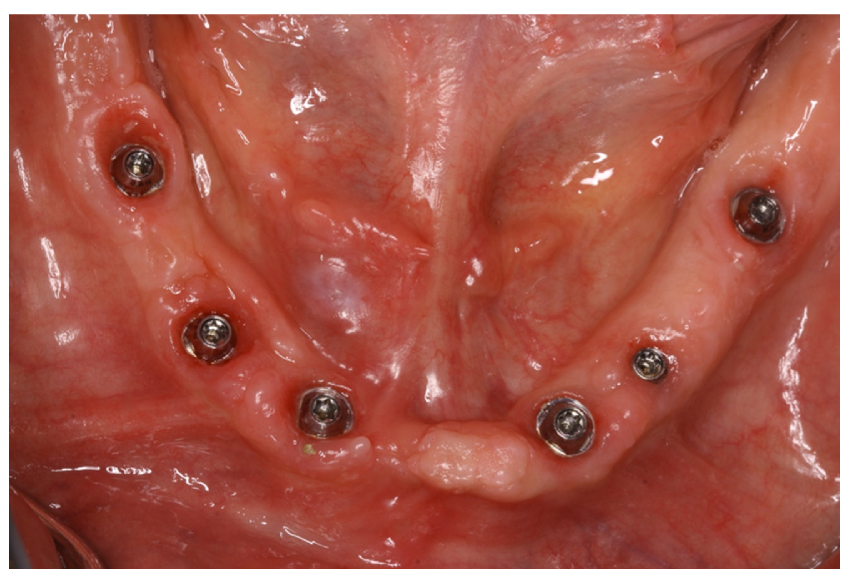 Prosthesis 07 00025 g007