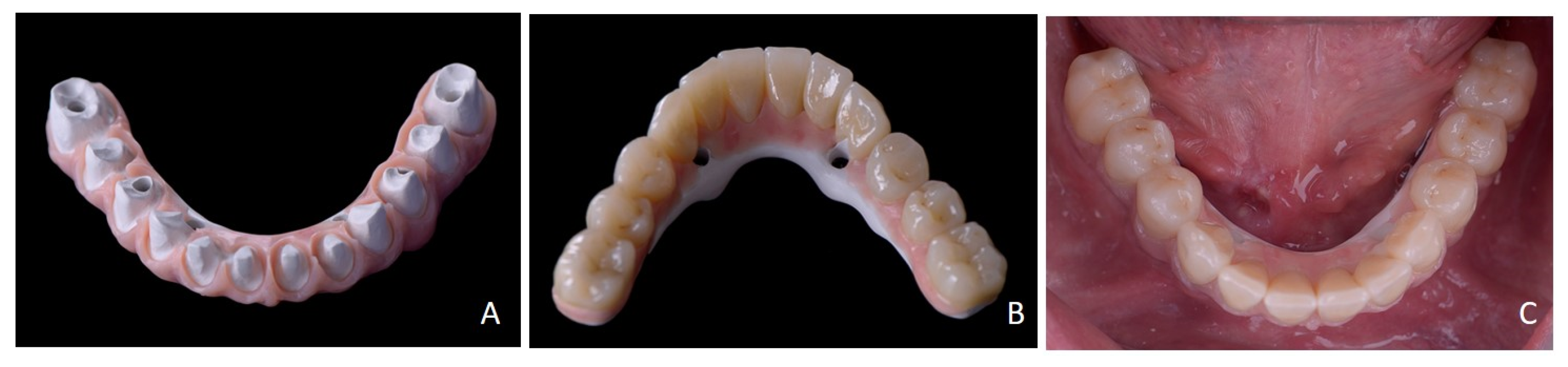 Prosthesis 07 00025 g008