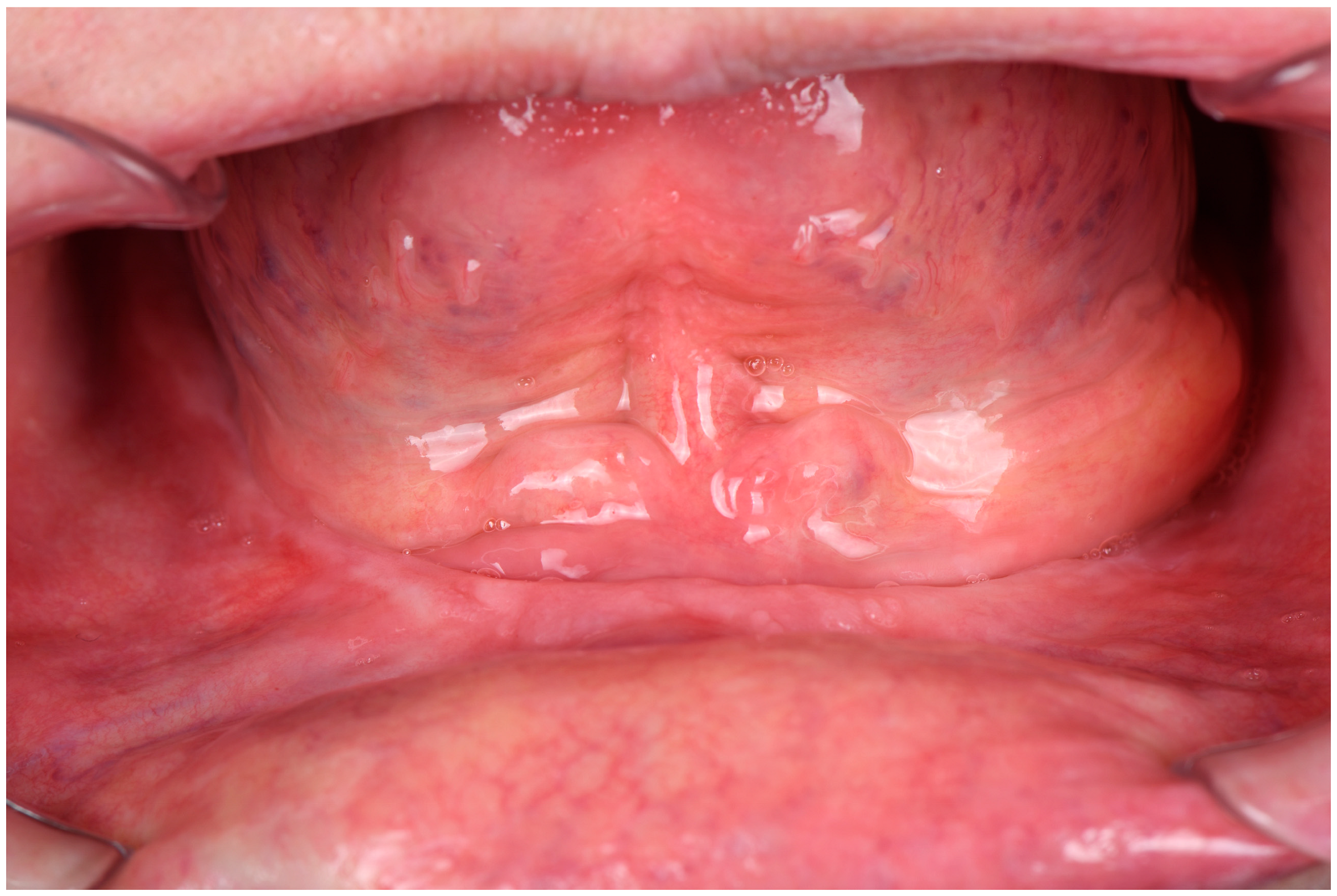 Prosthesis 07 00029 g001