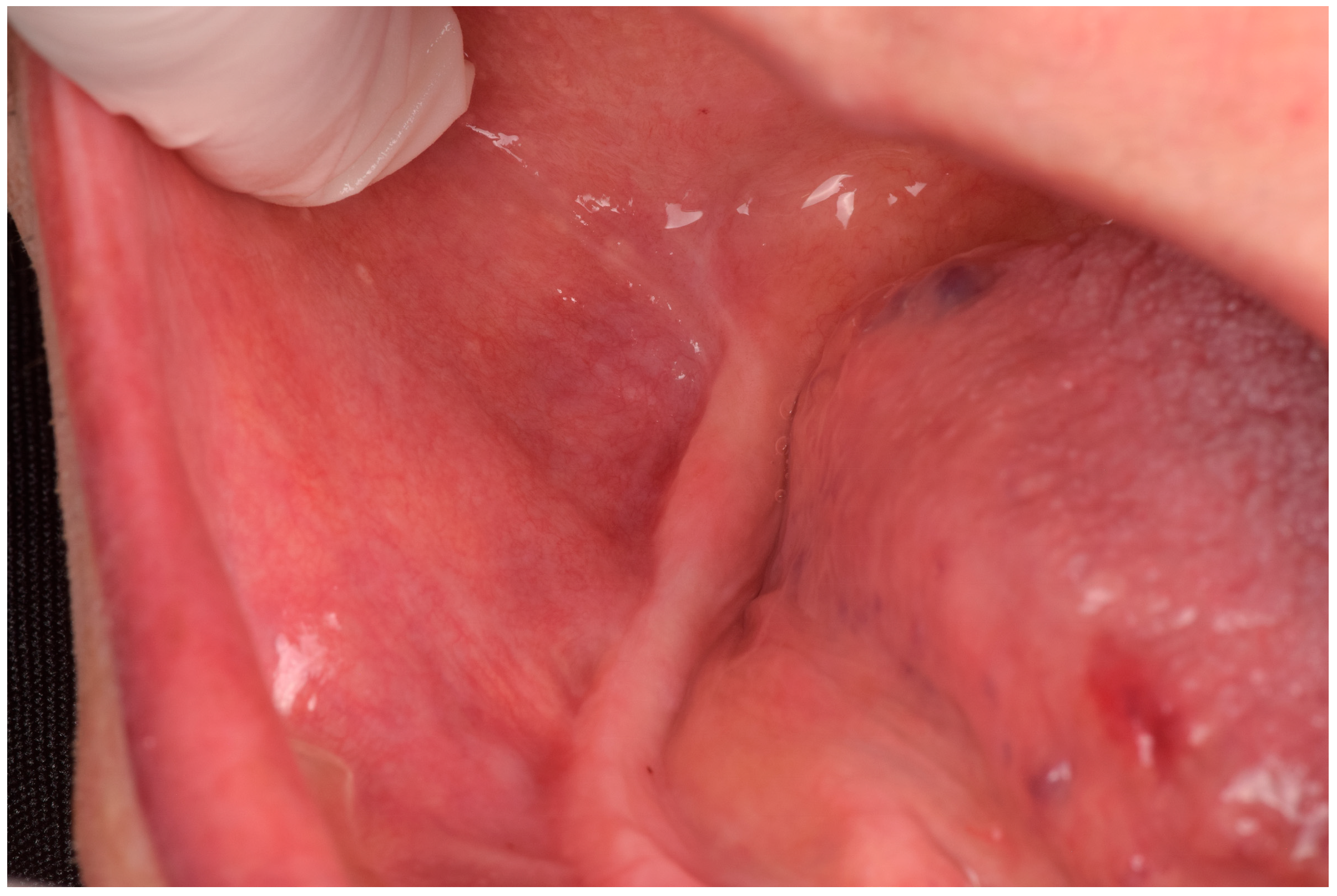 Prosthesis 07 00029 g007